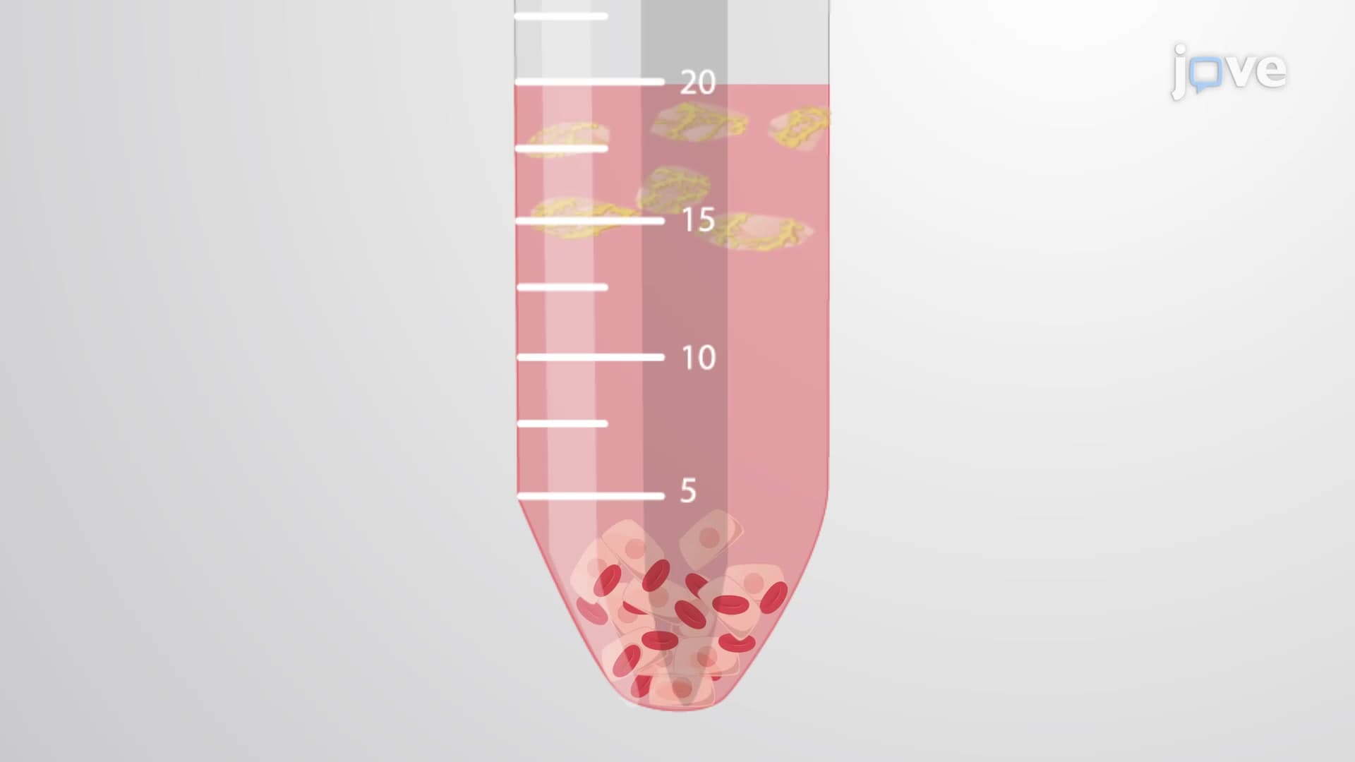 Mesothelial Cell Isolation: A Technique to Isolate Primary Mesothelial Cells From Human Omentum Tissue Specimen