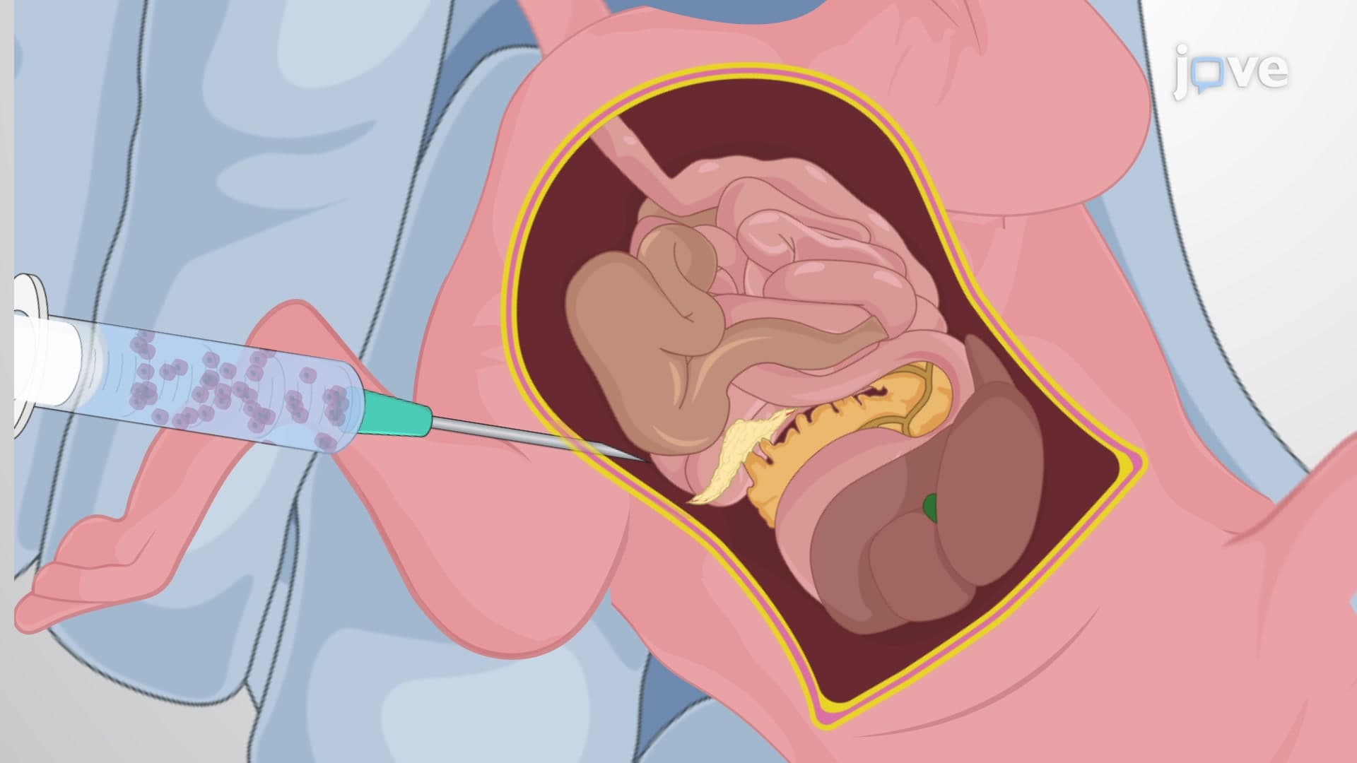 Intraperitoneal Injection of Cells: A Method of Delivering Cancer Cells into the Peritoneal Adipose Tissue of Murine Model