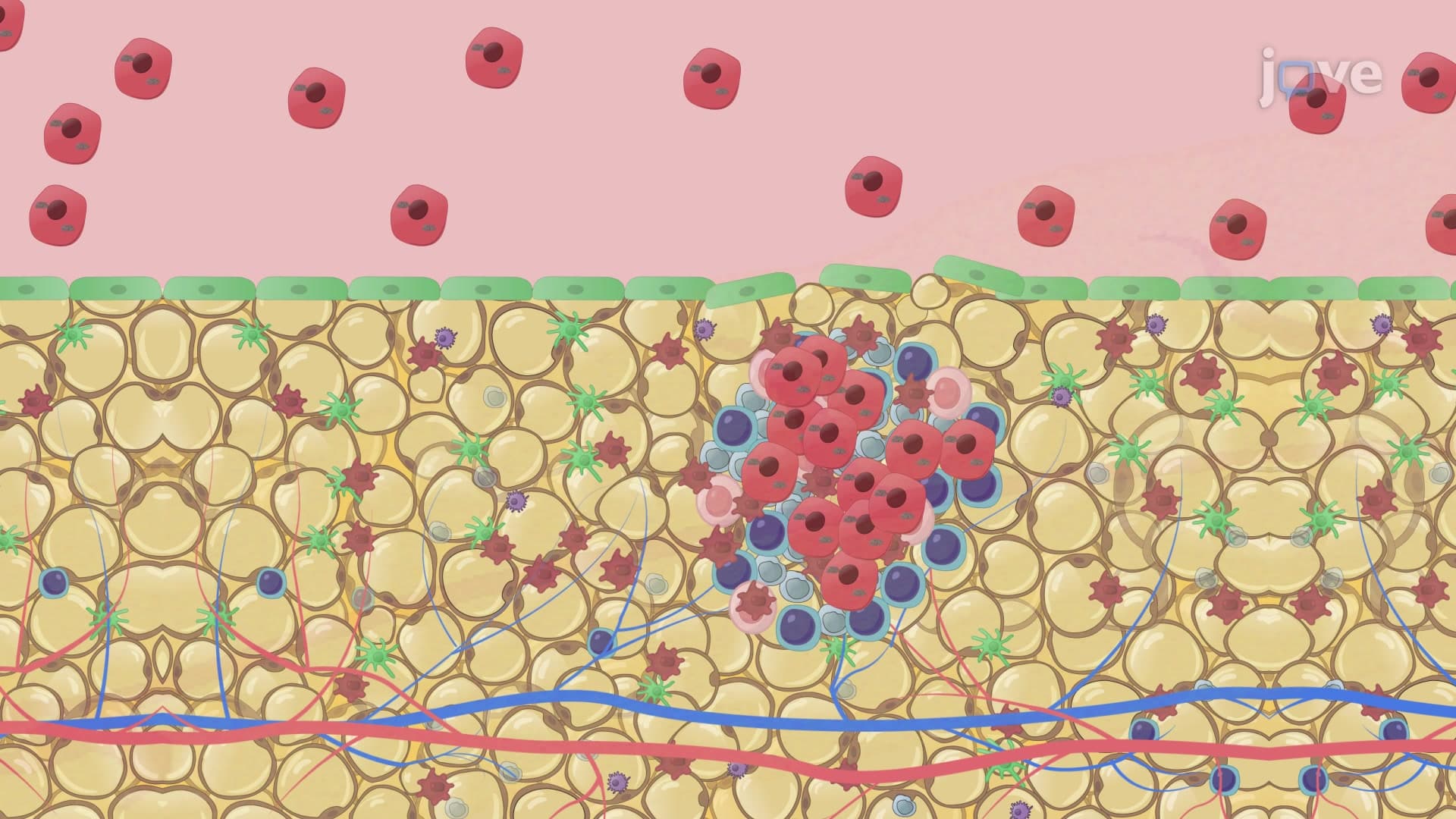 Modeling Ovarian Cancer Cell Colonization of Omentum: An Ex Vivo Method to Establish Milky Spot Colonization of Fluorescently Labeled Ovarian Cancer Cells in Murine Omentum Explants