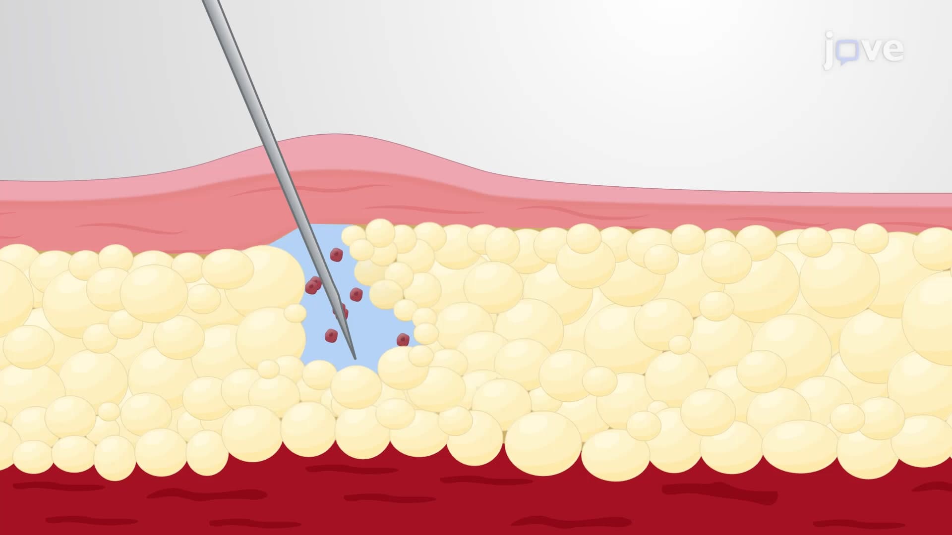 Ovarian Fat Pad Transplantation Assay: An In Vivo Technique to Introduce Cells into Ovarian Fat Pad in Mouse Models
