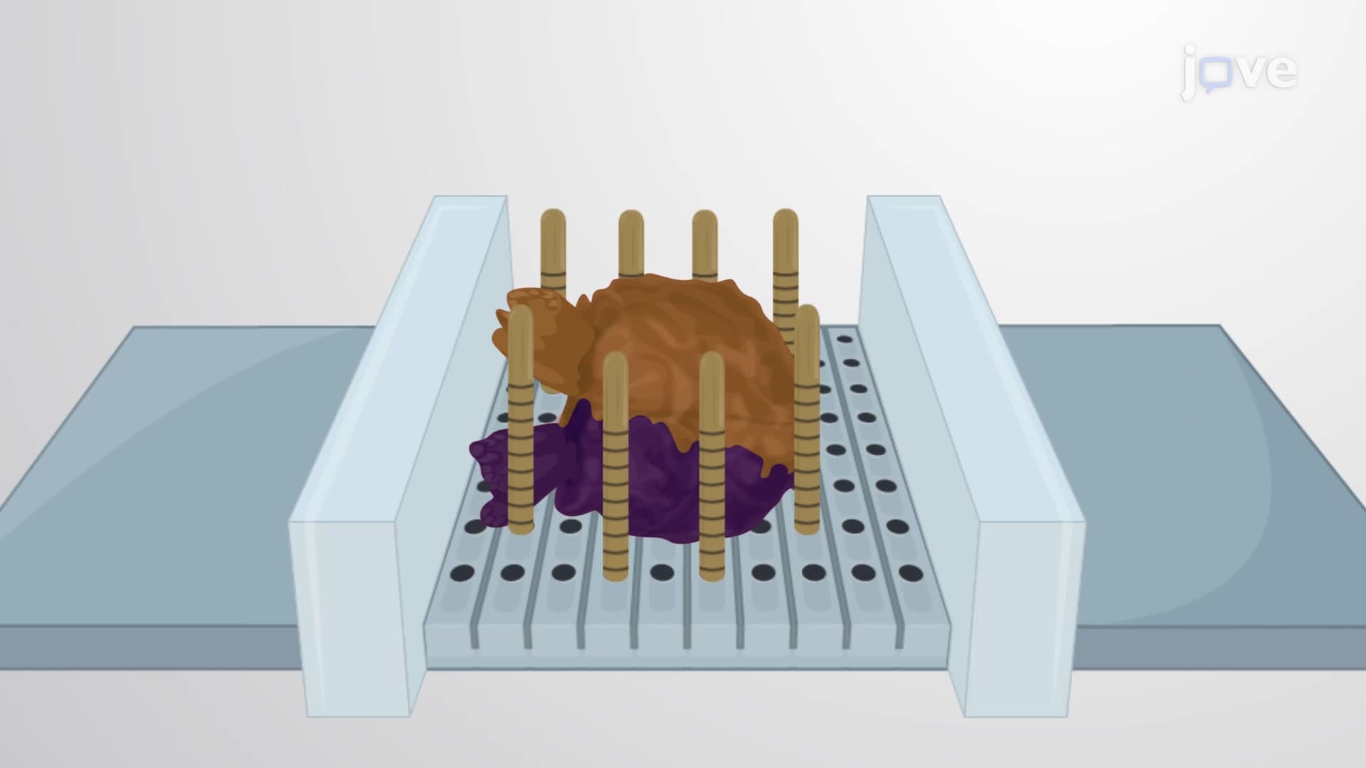 Sampling Prostate Cancer Tissue for Biobanking: An MRI-guided Targeted Technique to Remove Biopsy Punches from Fresh Tumor Tissue