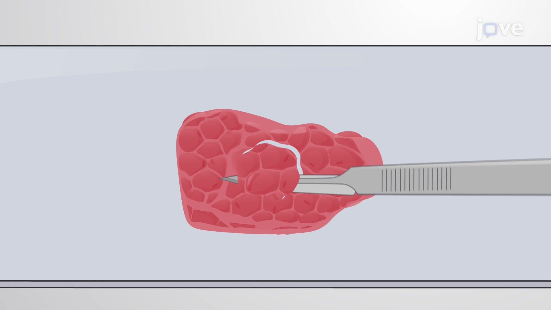 FFPE Tumor Tissue Macrodissection: A Technique to Obtain Specific Tumorous Tissue from Unstained Specimens