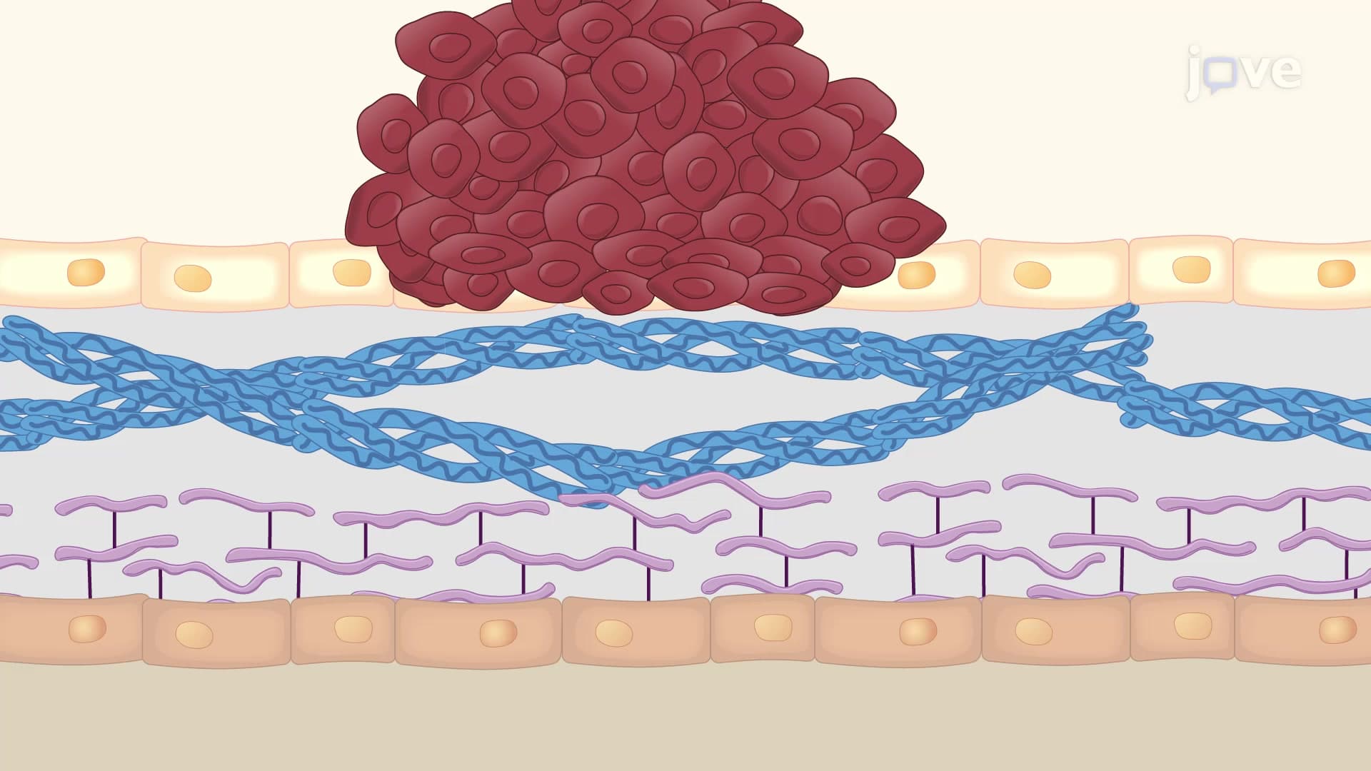 Elastic Fiber Staining of Slide Sections: A Technique to Observe Gastric Cancer Metastasis