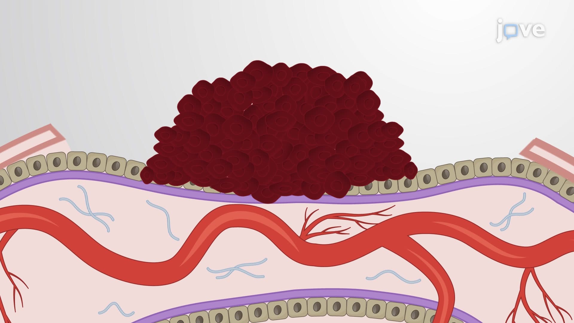 Chick Chorioallantoic Membrane Harvest: A Method to Isolate Tumor Graft-bearing Chorioallantoic Membrane from Chicken Egg
