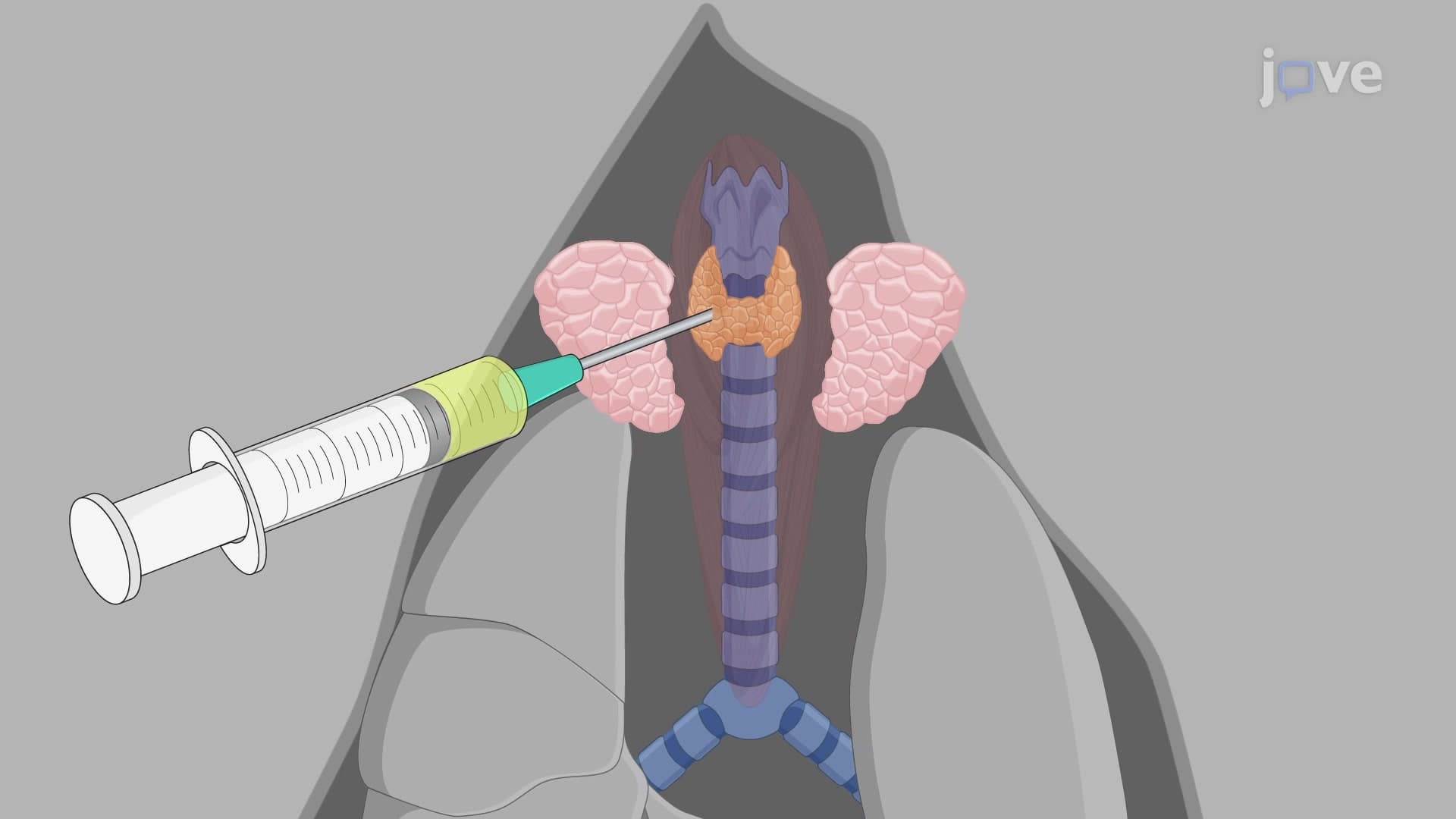 Orthotopic Inoculation of Thyroid Cancer Cells into Murine Thyroid: A Procedure to Establish Orthotopic Thyroid Cancer Mouse Model