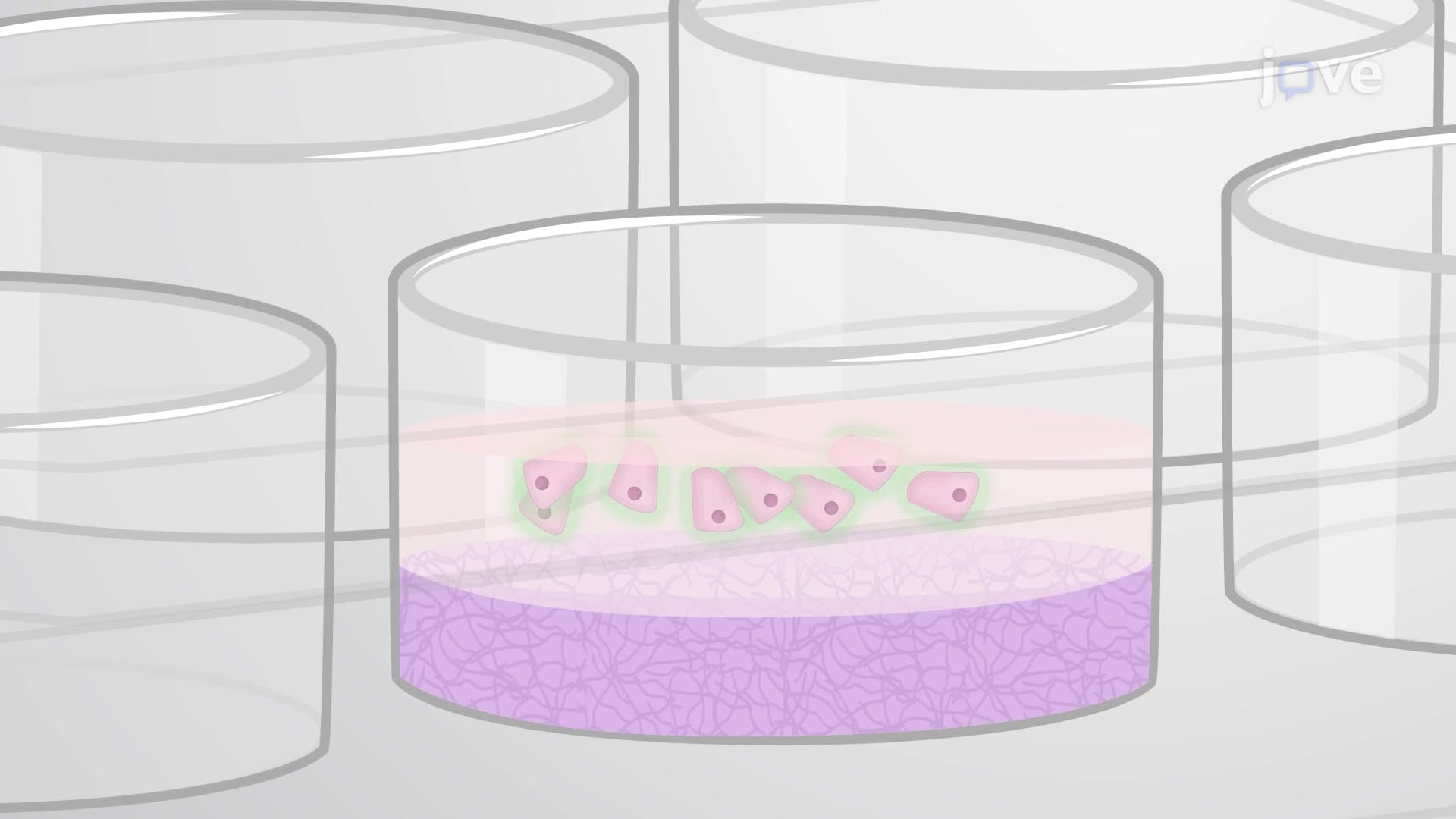 Culturing Salispheres from Salivary Gland Tissue: A Method to Develop Salispheres from Human Salivary Gland Derived Epithelial Cells