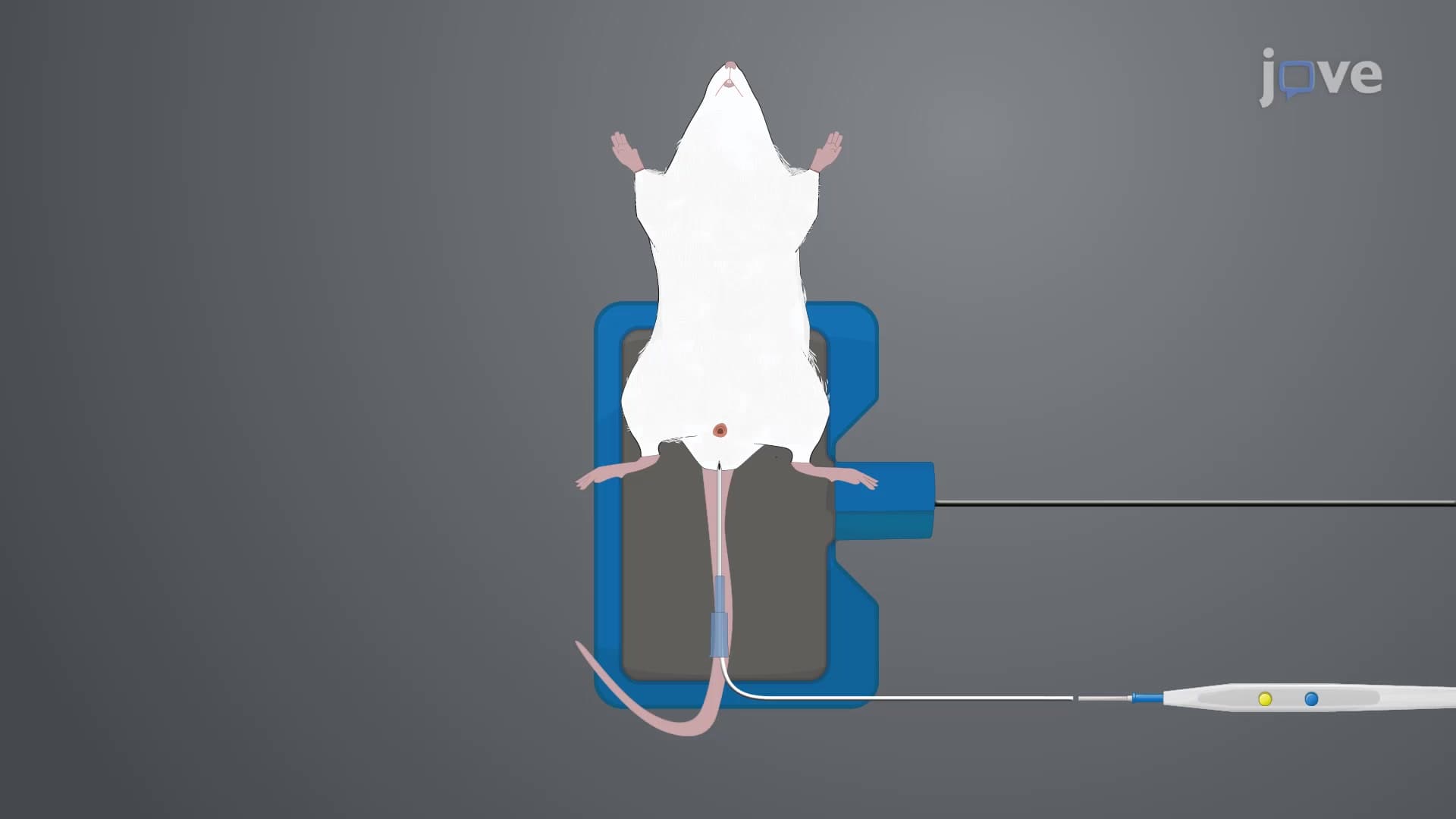 Patient-derived Tumor Xenografting: A Technique to Generate Experimental Mouse Model for Evaluating Urothelial Cell Carcinoma