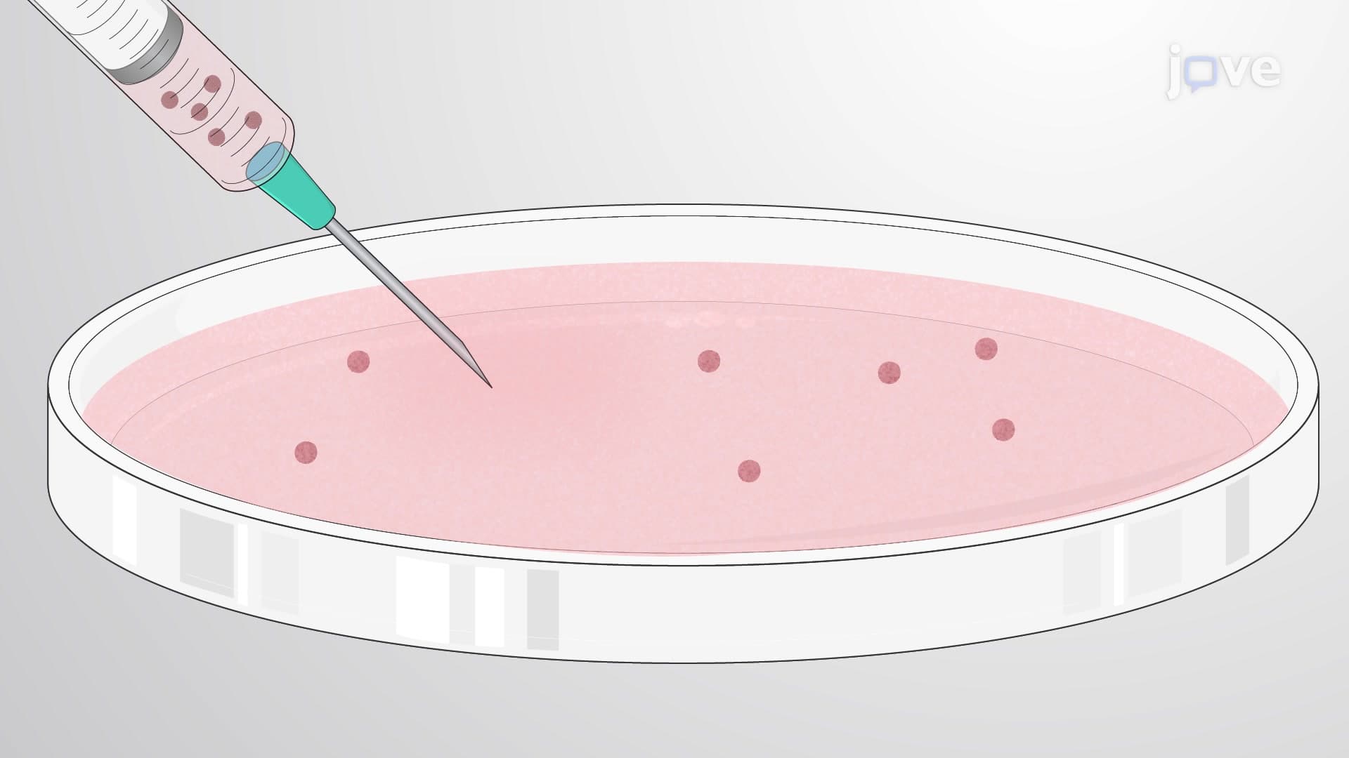 Bladder Tumor Organoid Model: A Method for Orthotopic Transplantation of Bladder Organoids into Recipient Murine Bladder