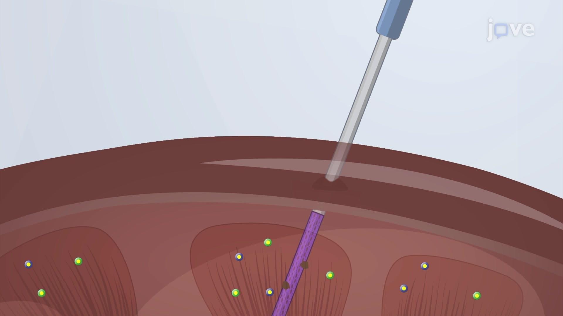 Solid Phase Microextraction Sampling: A Probe-based Technique for Sample Extraction from Graft Tissues
