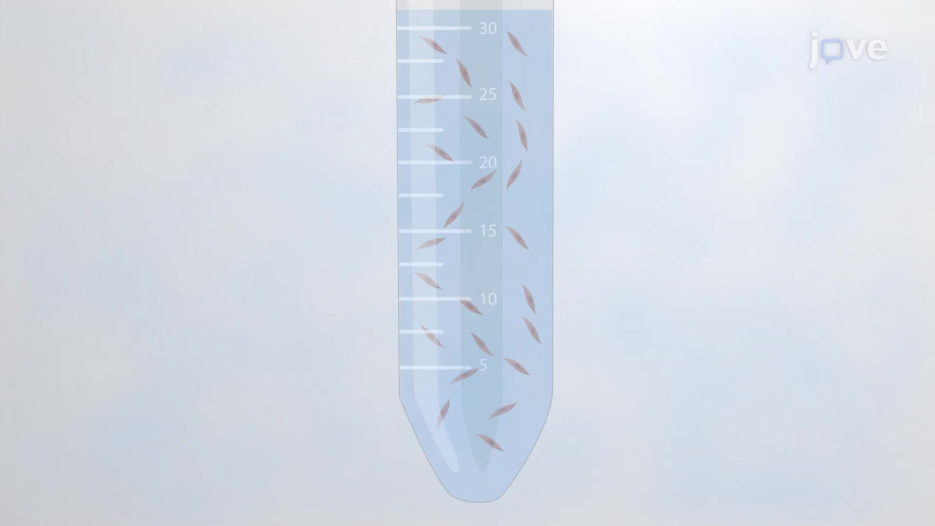 Detrusor Smooth Muscle Cell Isolation: An Enzymatic Digestion Procedure to Obtain DSM Cells from Human Urinary Bladder Specimens