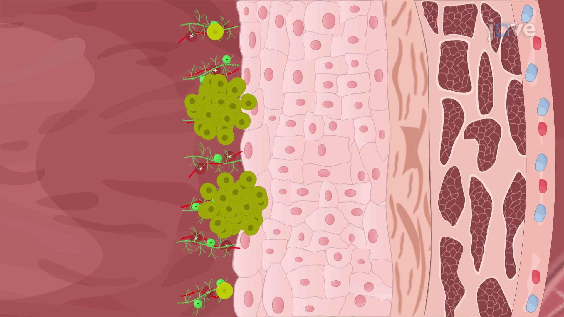 Modeling Orthotopic Bladder Tumor in Mouse Model: A Procedure for Intravesical Administration of Cancer Cells into Murine Bladder