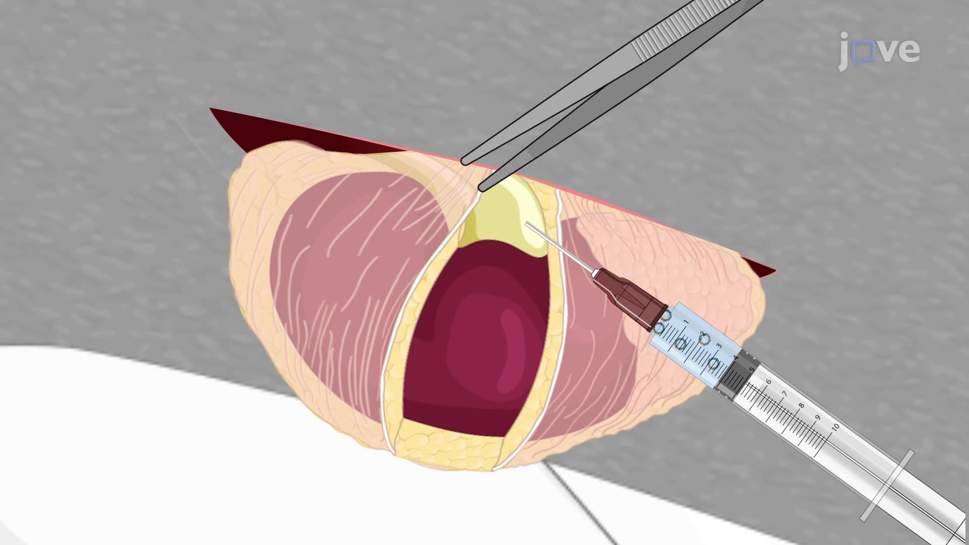 Hydrodynamic Renal Pelvis Injection: A Technique to Directly Deliver DNA into Kidney Cells of Murine Model
