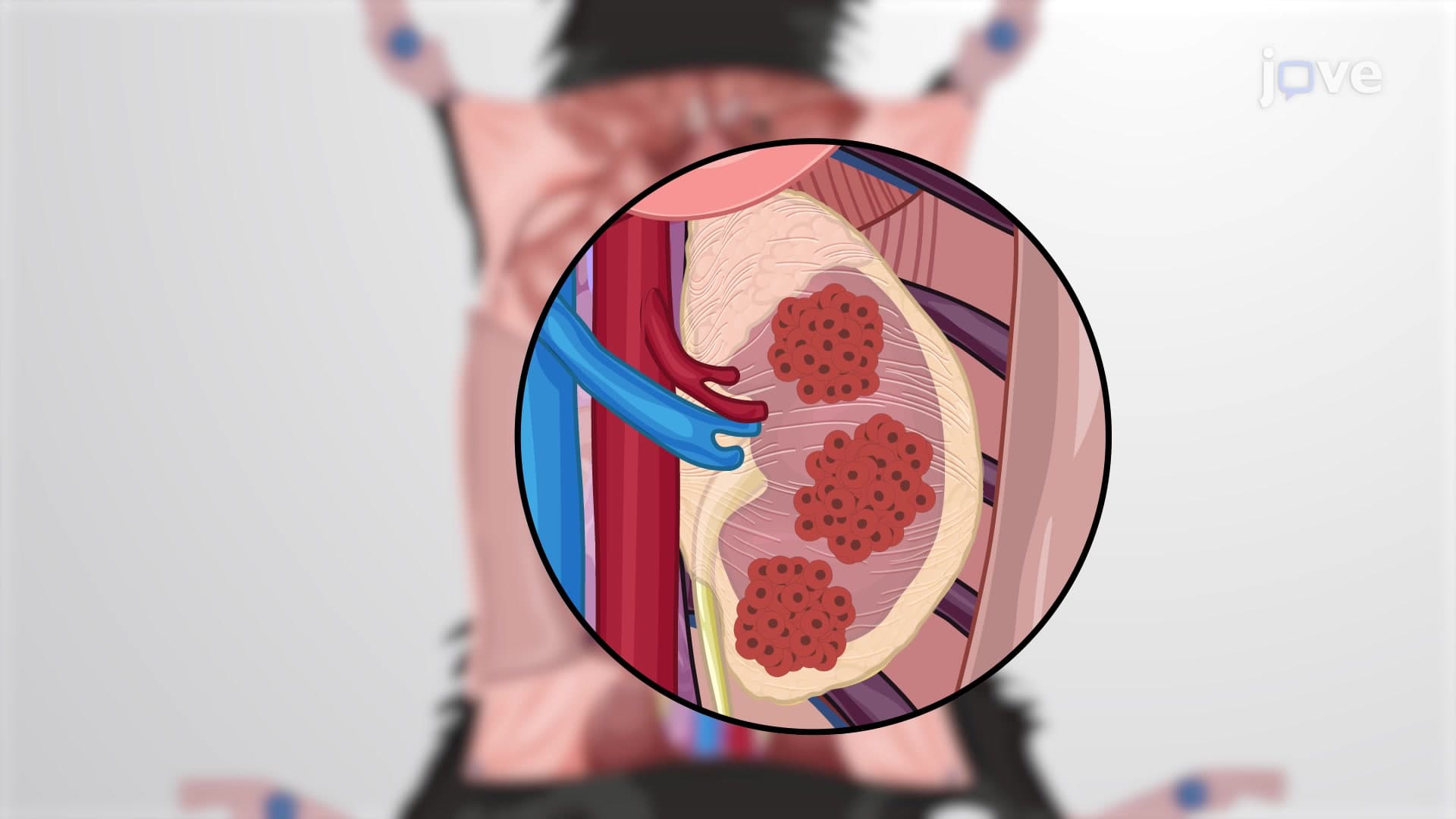 Generating Renal Cell Carcinoma Model: A Protocol to Develop Orthotopic RCC Murine Model by Intrarenal Implantation of Cancer Cells