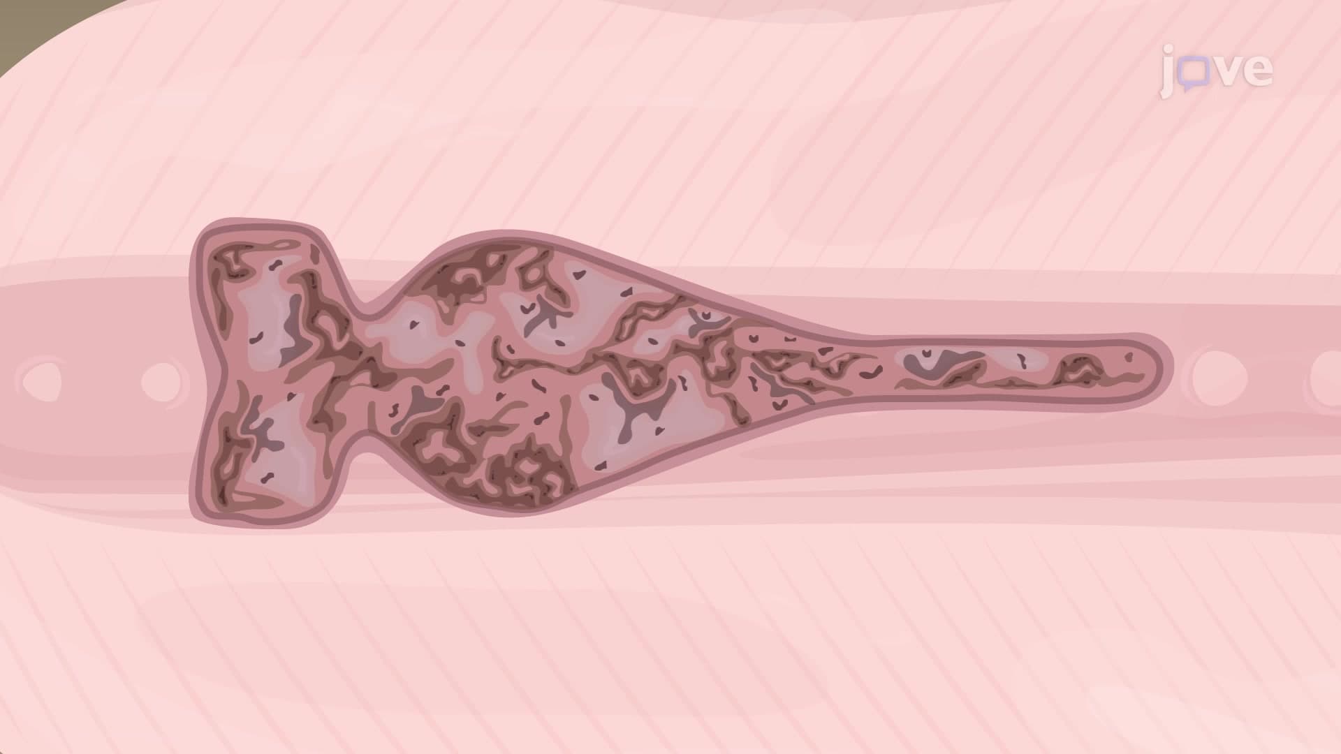 Depigmentation and Prestaining of Zebrafish Kidney: A Technique to Prepare Adult Zebrafish Kidney for Staining