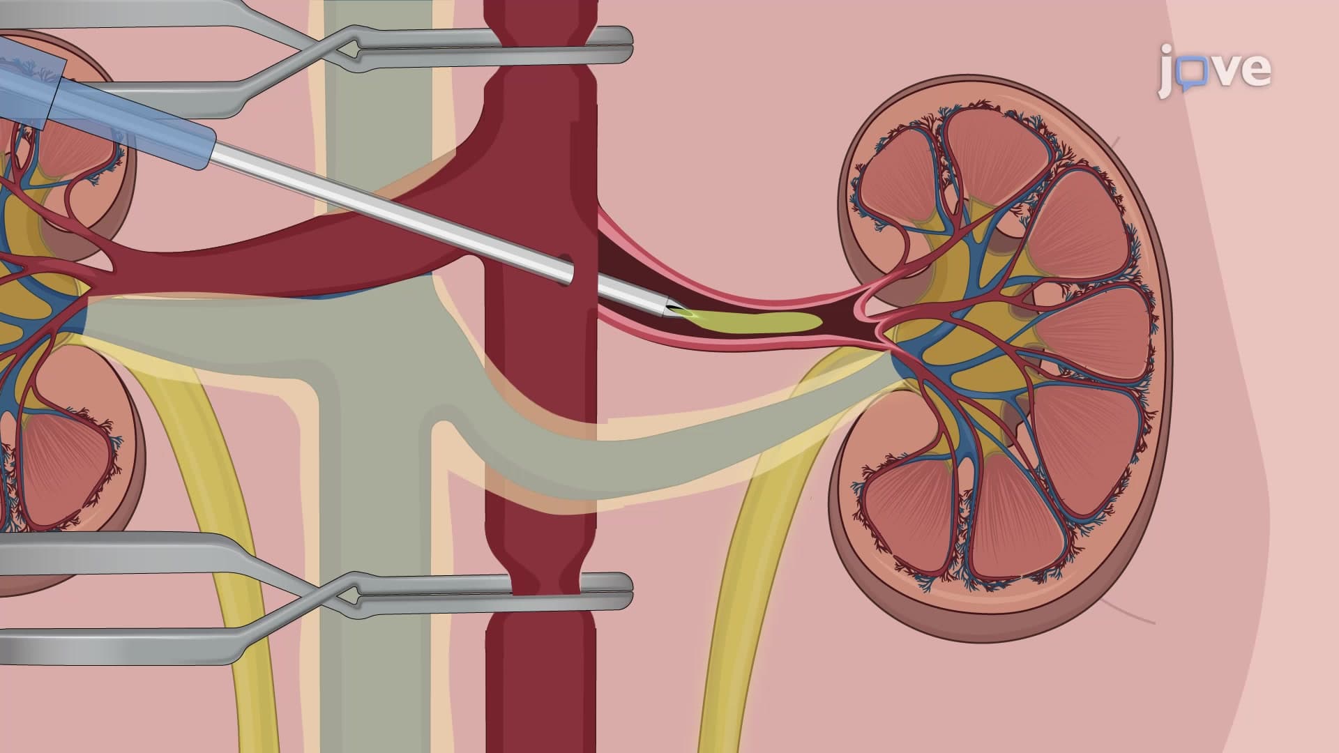 Intrarenal Drug Delivery in Rats: A Method to Deliver Therapeutic Drugs in Rat Kidney via Intra-arterial Injection