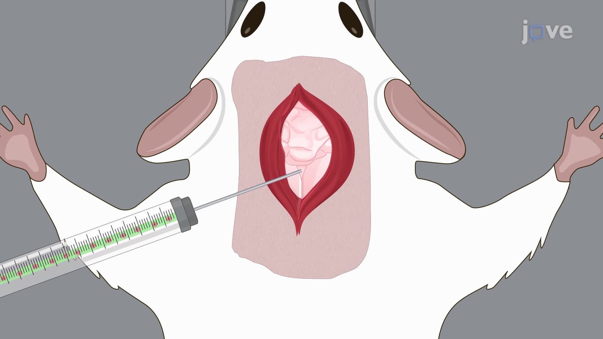 Surgical Cisterna Magna Injection: A Method for Administering Tumor Cells Directly into Central Nervous System of Murine Model