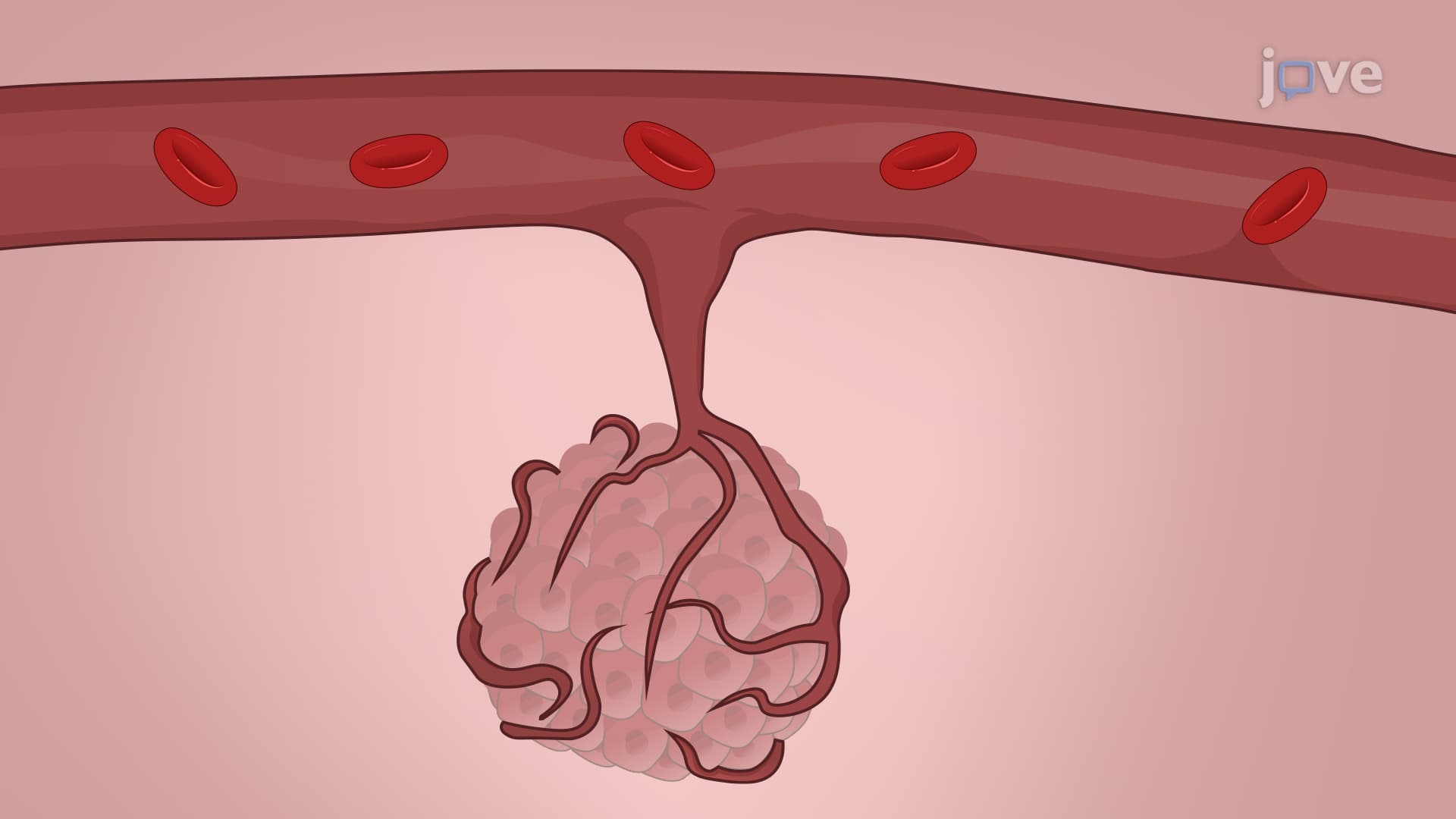 Brain Tumor Stem Cell (BTSC) Migration Assay for Drug Treatment Studies: An In Vitro Live-cell Imaging Technique to Analyze the Effect of Drug Treatment on Migration of BTSCs