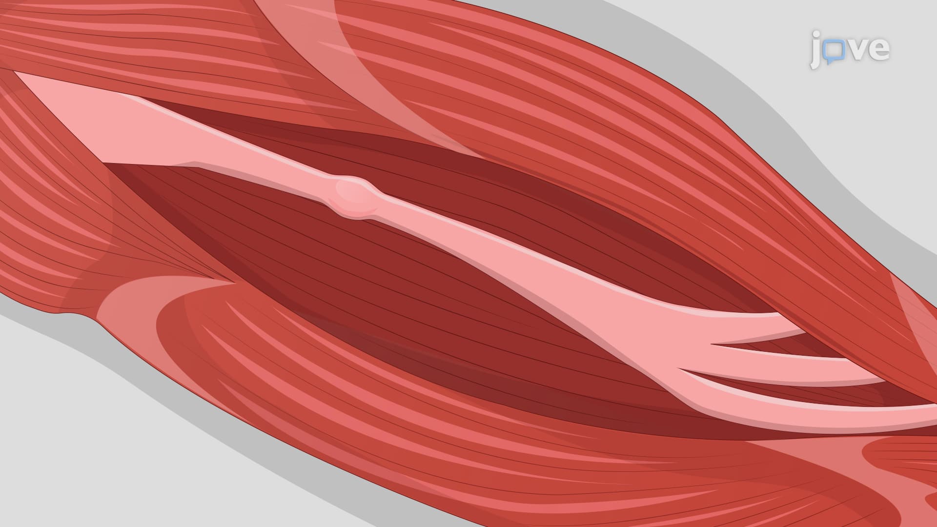 Murine Perineural Invasion Model: Generating an In Vivo Model to Simulate Perineural Invasion in Mouse Sciatic Nerve