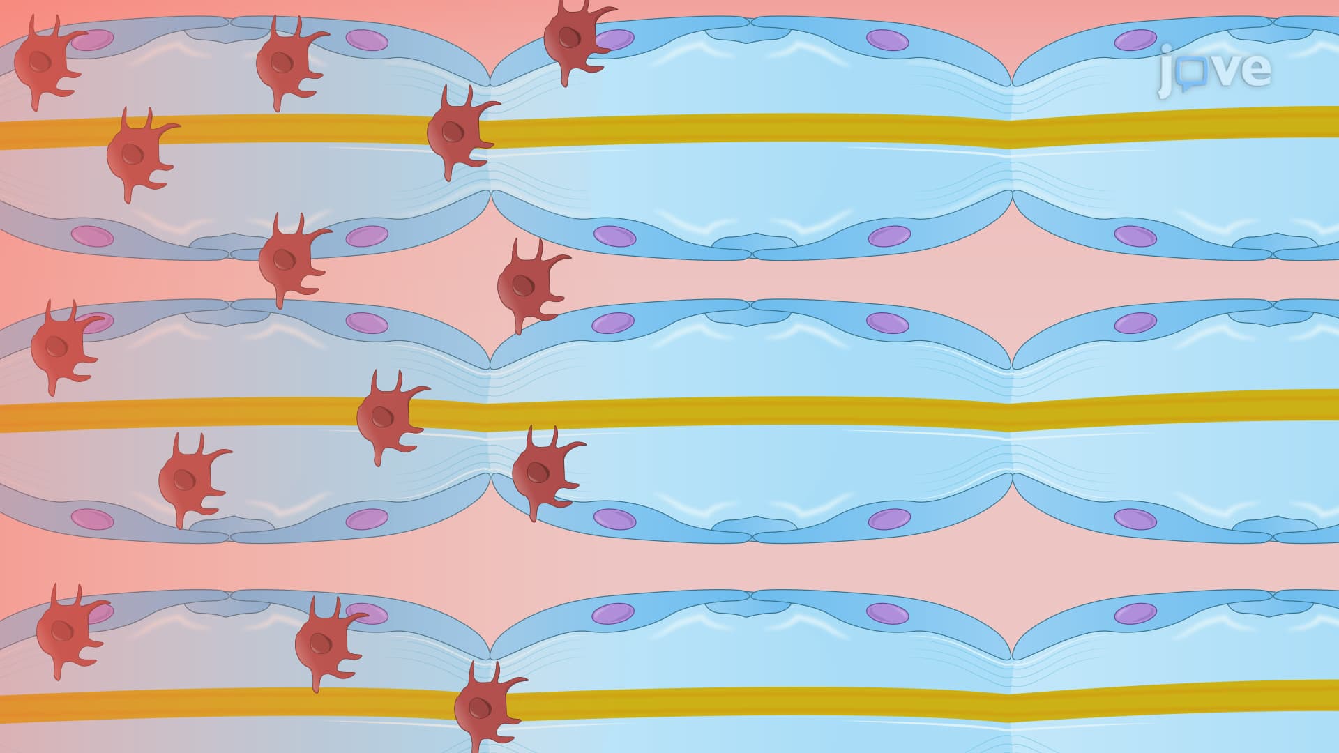 Murine Sciatic Nerve Model of Perineural Invasion or PNI: Extraction and Processing of Sciatic Nerve to Understand Invasion by Cancer Cells