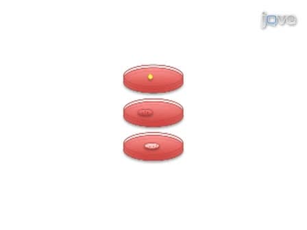 Transurethral Induction of Mouse Urinary Tract Infection