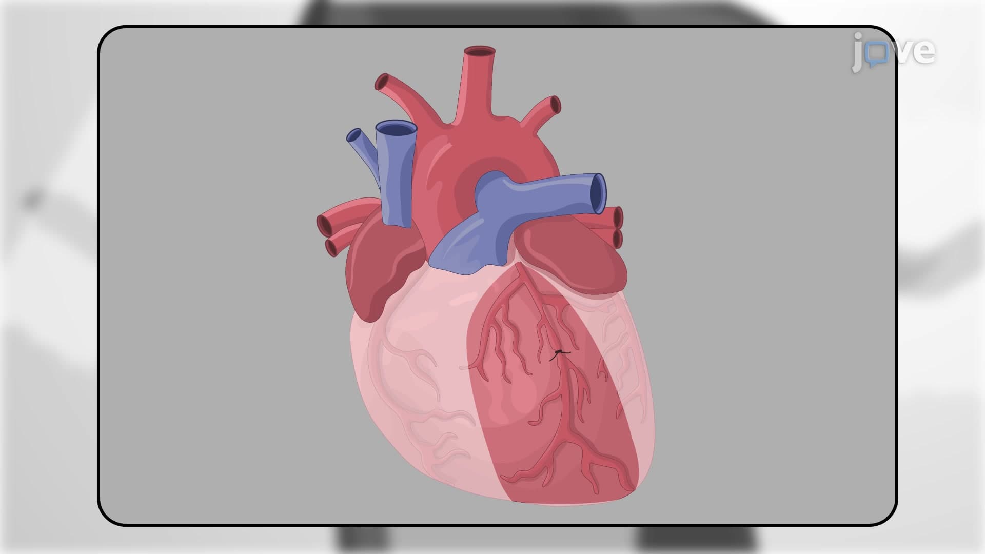 Generating Murine Model of Myocardial Infarction: A Surgical Procedure for Permanent Ligation of Left Anterior Descending Coronary Artery in Mouse Model