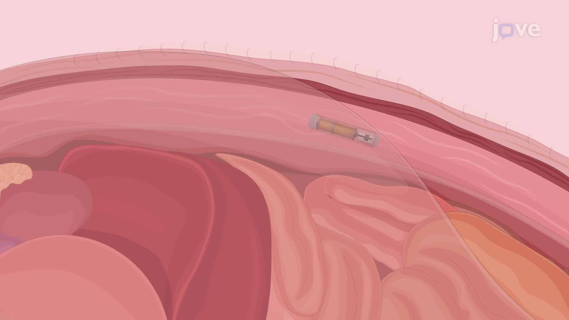 Surgical Implantation of Temperature Telemetric Monitoring System in Mouse Model: A Surgical Procedure to Implant Temperature Telemetric Device to Measure Mouse Core Body Temperature
