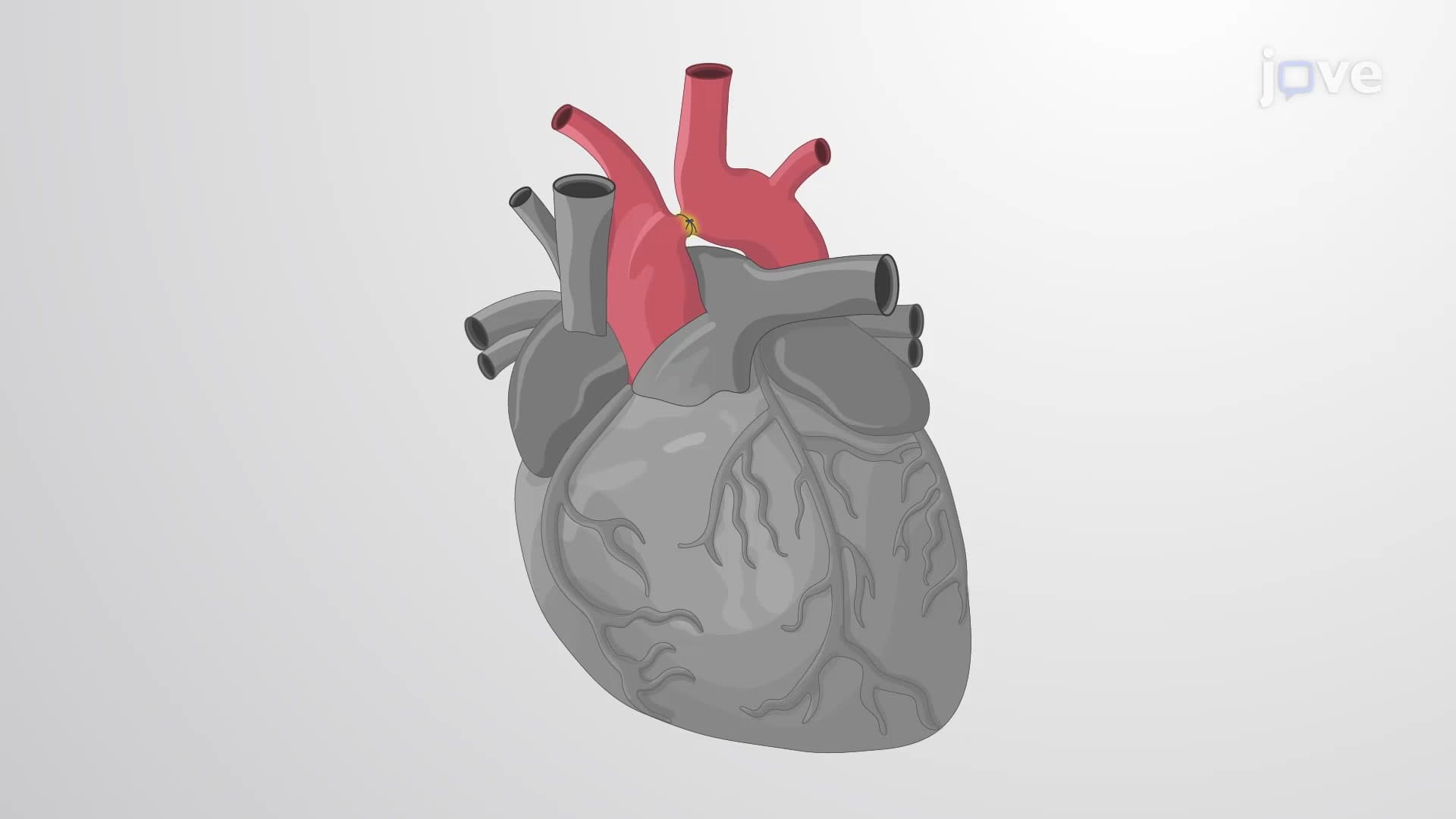 Transverse Aortic Arch Banding in Mouse Model: A Minimally Invasive Technique in Mice for Induction of High Pressure in the Left Ventricle