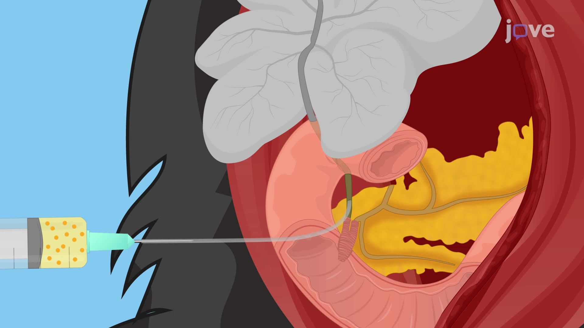 Biliary System Resin Casting: A Technique for Analyzing 3D Architecture of Biliary System in Murine Model Using Radiopaque Resin Injection