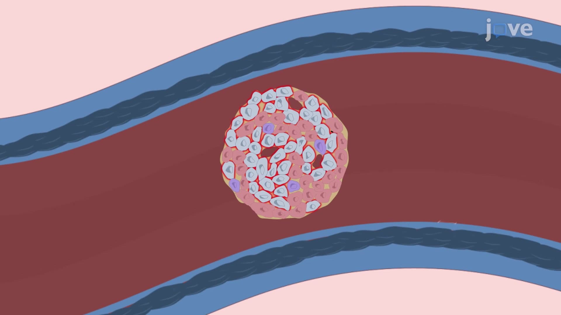 Murine Model of Islet Transplantation: A Surgical Method to Infuse Pancreatic Islets in Portal Vein and Prevention of Postoperative Bleeding