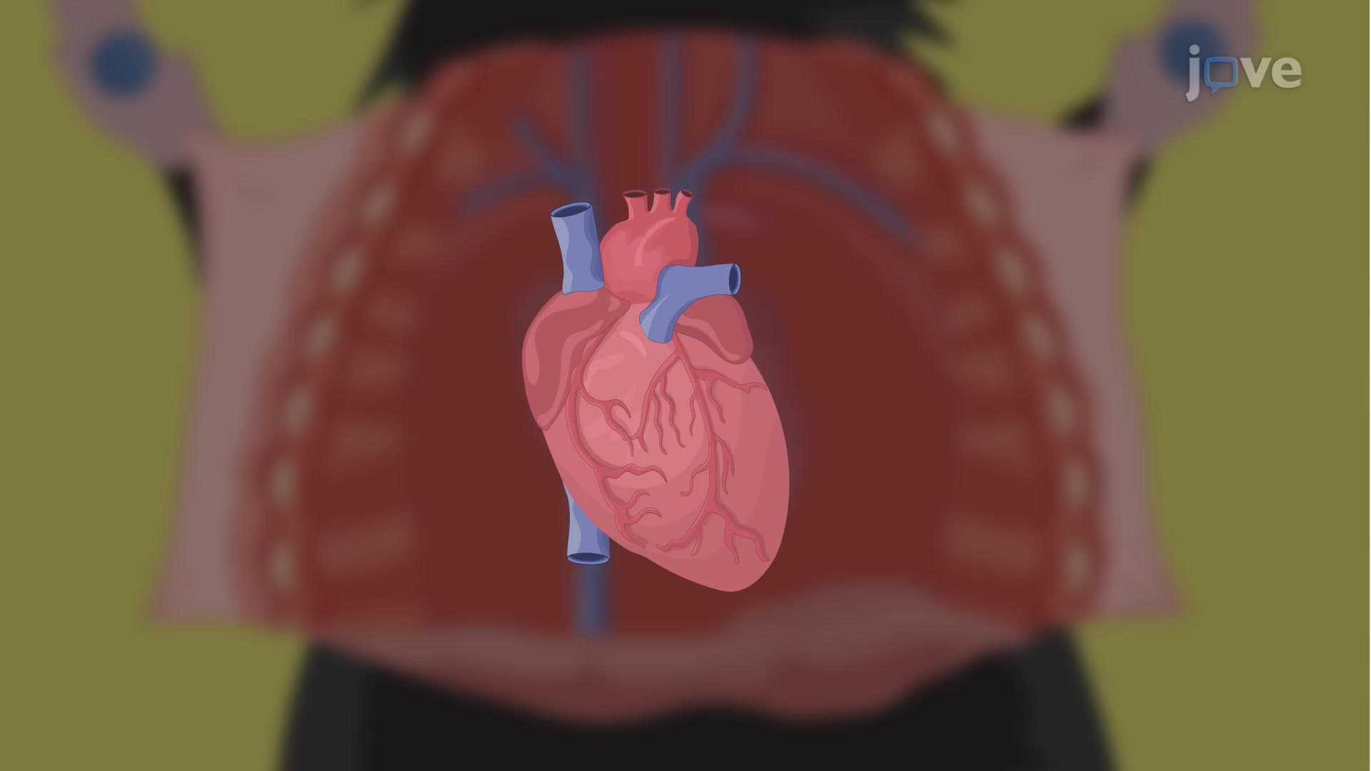 Sinoatrial Node Isolation from Mouse Model: A Procedure to Harvest SA Node from Murine Heart