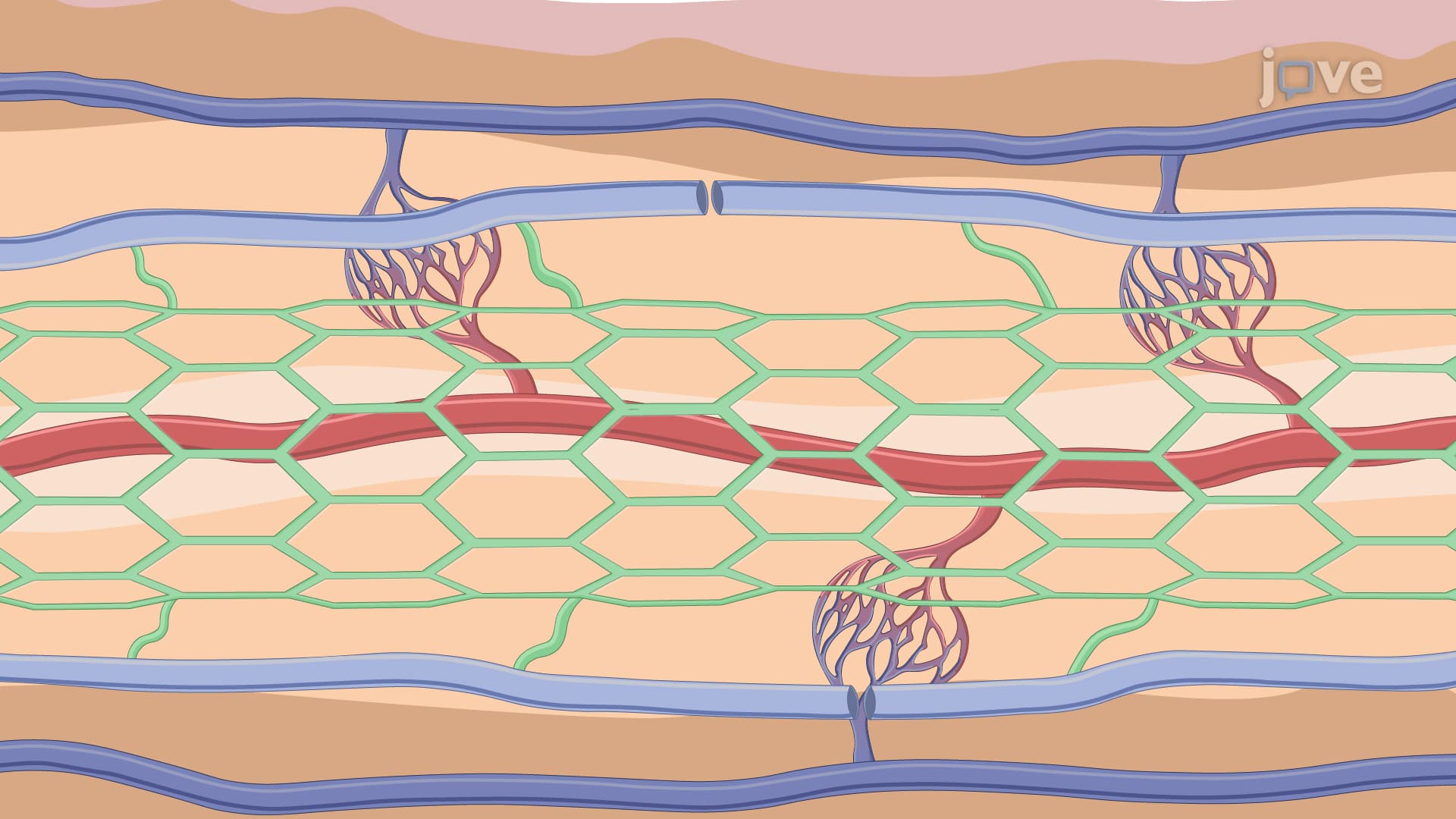 Murine Tail Lymphedema Model: An In Vivo Technique to Generate Sustained Lymphedema in Murine Tail