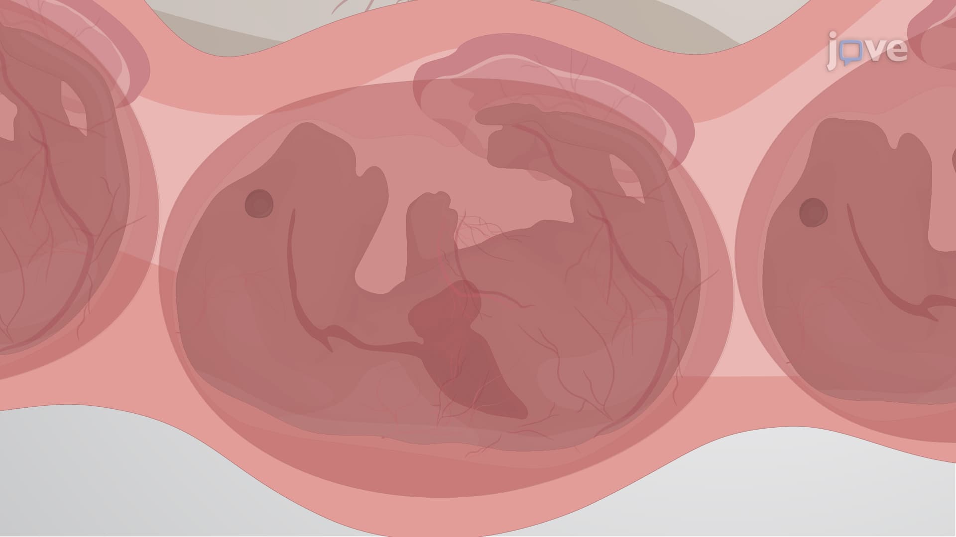 Modeling Transuterine Fetal Tracheal Occlusion in Murine Model: A Surgical Procedure for Ligation of the Fetal Trachea Within a Pregnant Mouse