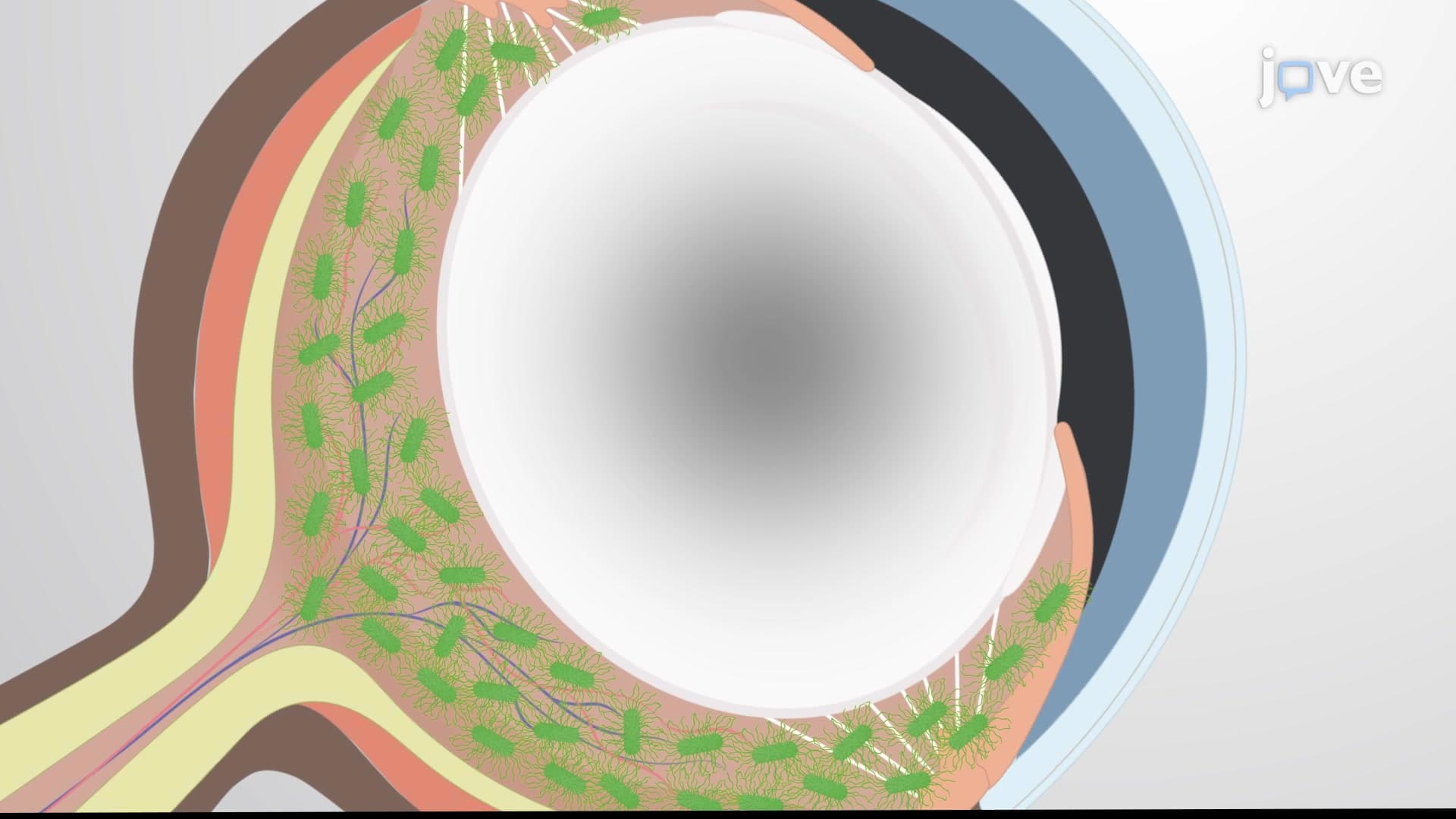 Bacterial Infection Quantitation Assay: A Method to Quantify Intraocular Bacterial Load in Mouse Model of Bacterial Endophthalmitis