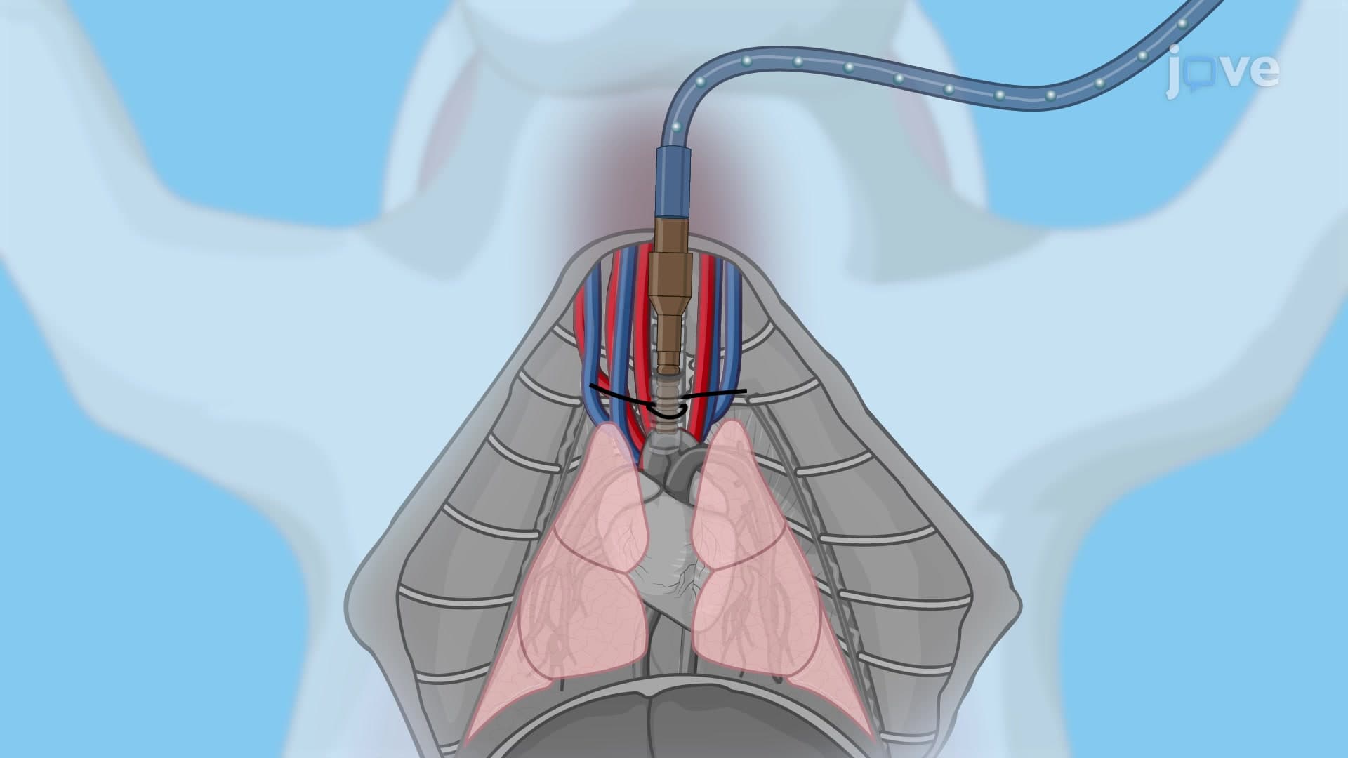 Tracheal Cannulation in Rabbit Model: A Procedure to Insert Tracheal Cannula into the Rabbit Trachea