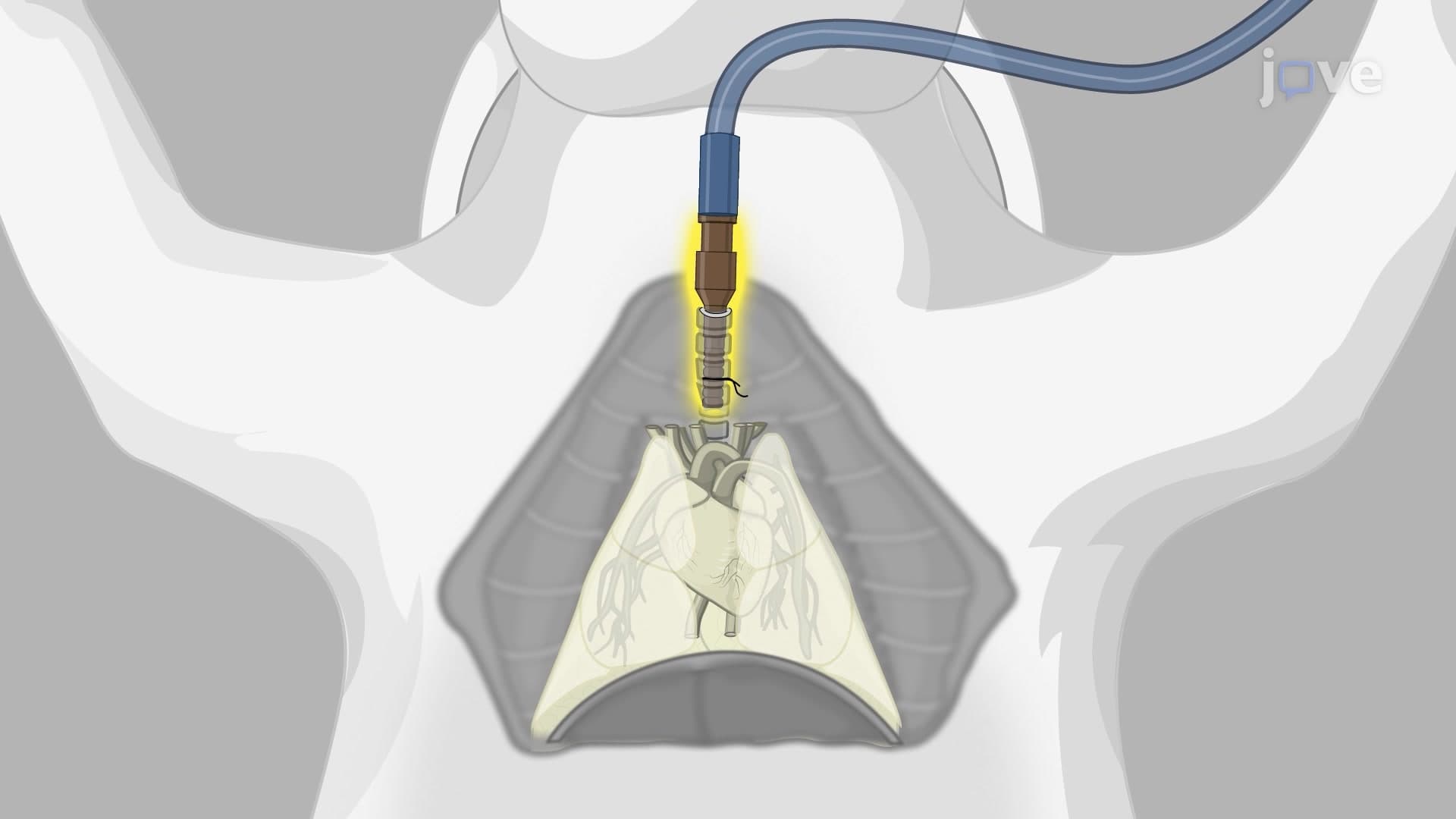 Cardiopulmonary Block Harvest from Rabbit: A Surgical Procedure to Retrieve Functional Heart-Lung Block from Rabbit Model