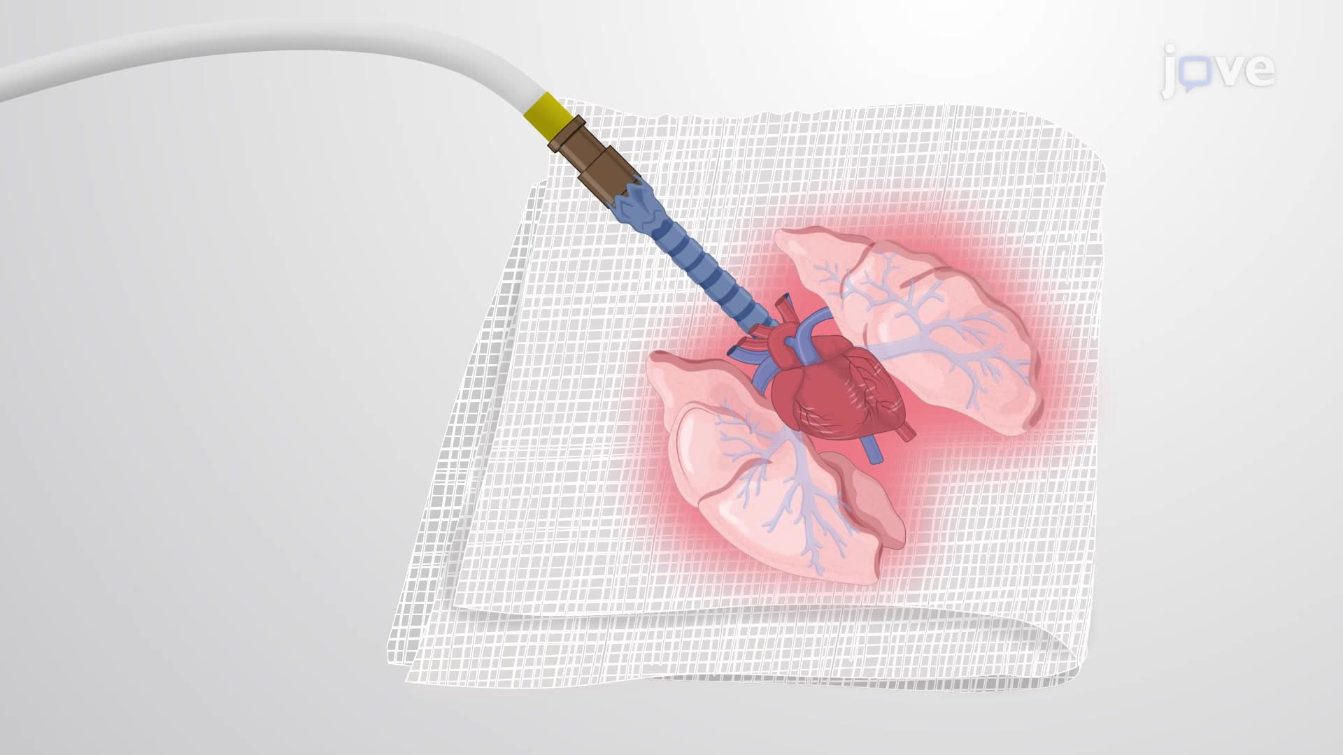 Ex vivo Lung Perfusion: A Technique for Pulmonary Research in a Rabbit Model