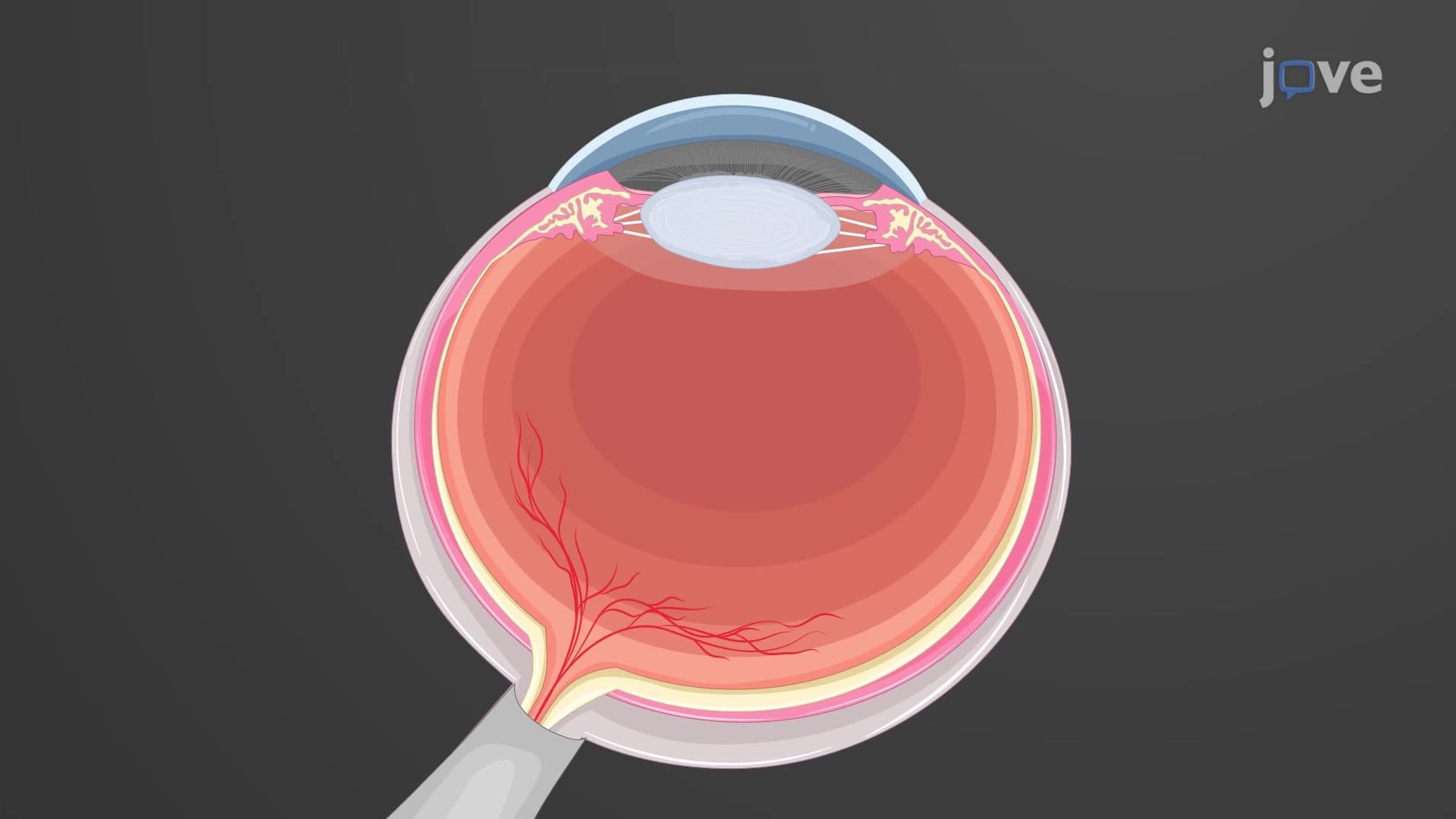 Isolating RPE and IPE Cells from Bovine Eye: A Procedure to Harvest and Culture Bovine Primary Pigment Epithelial Cells