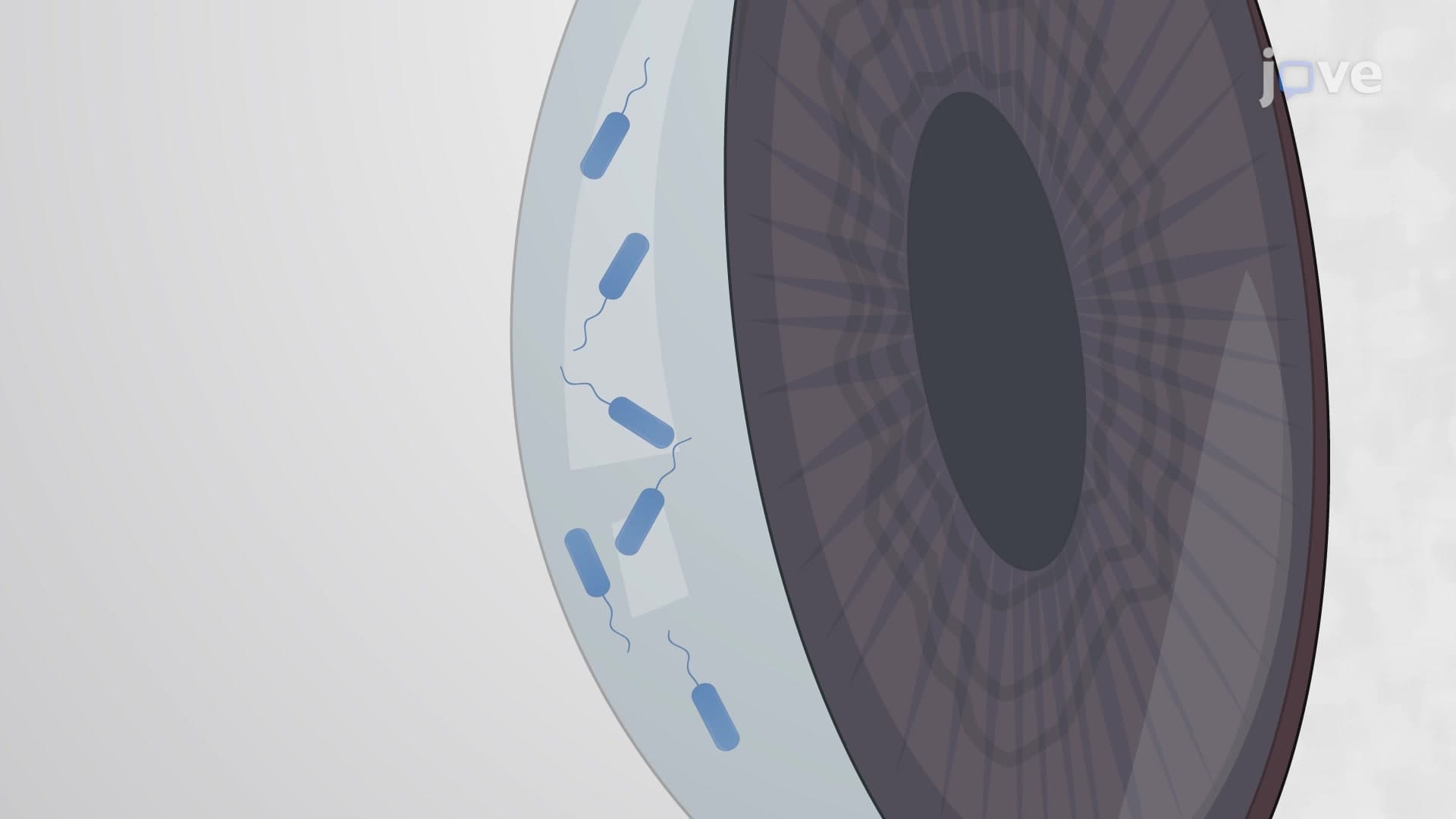 Porcine Ex vivo Cornea Model of Bacterial Keratitis: A Technique to Establish Bacterial Infection in Corneal Epithelial Cells
