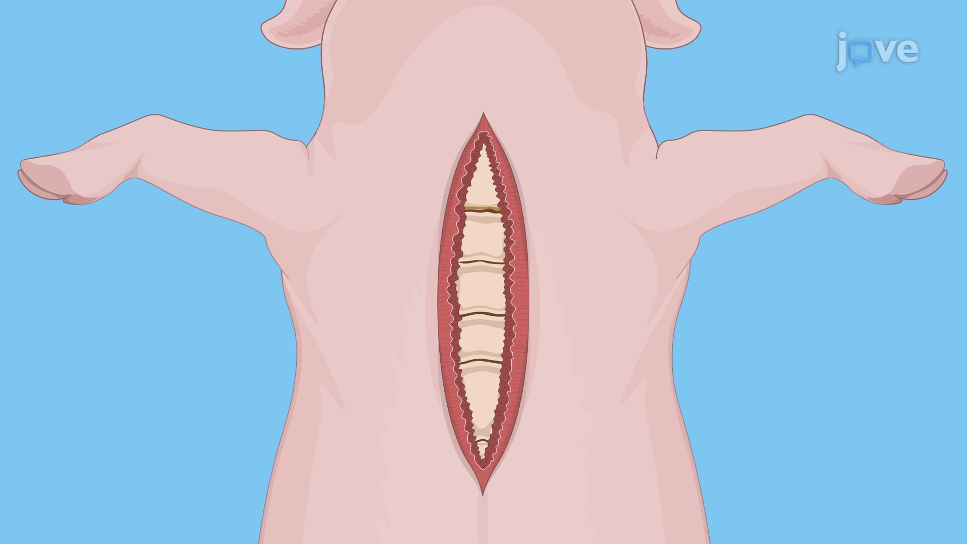 Porcine Heart Excision: A Protocol to Extract Porcine Heart for Cardiac Transplant