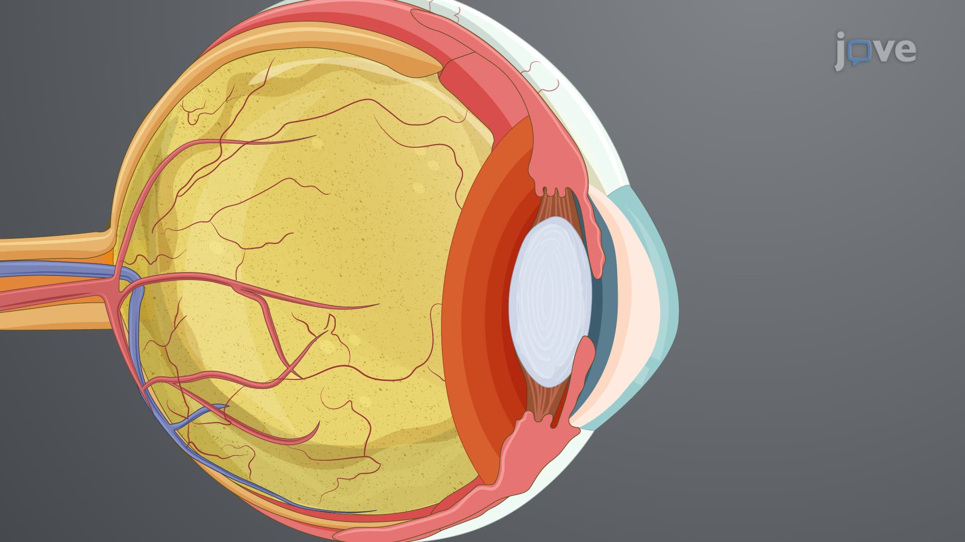 Laser-assisted Selective Ablation of Porcine Corneal Endothelial Cells: A Technique to Induce Focused Porcine Corneal Endothelial Injury for Ex Vivo Studies