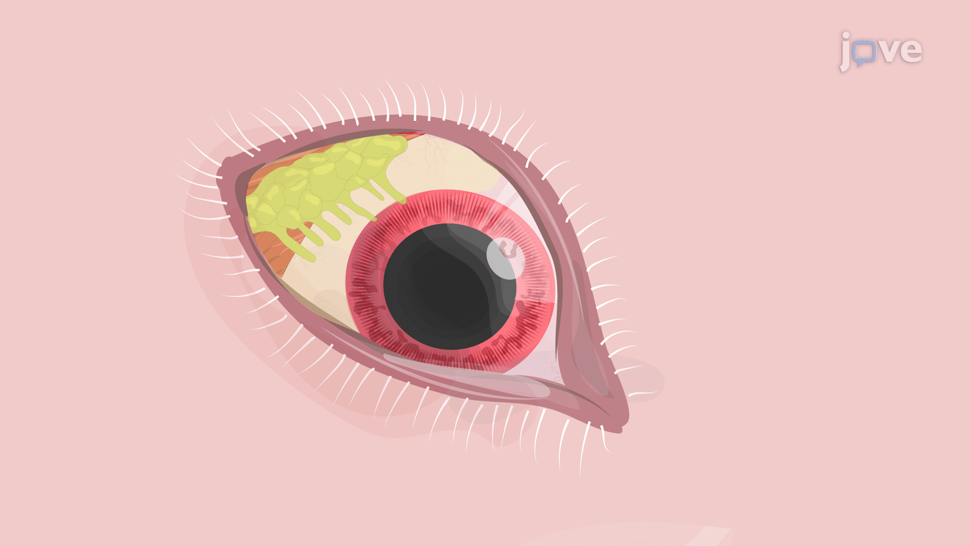 Performing Injection into Palpebral Portion of the Superior Lacrimal Gland: A Technique for Inducing Dry Eye Disease in Rabbit Model
