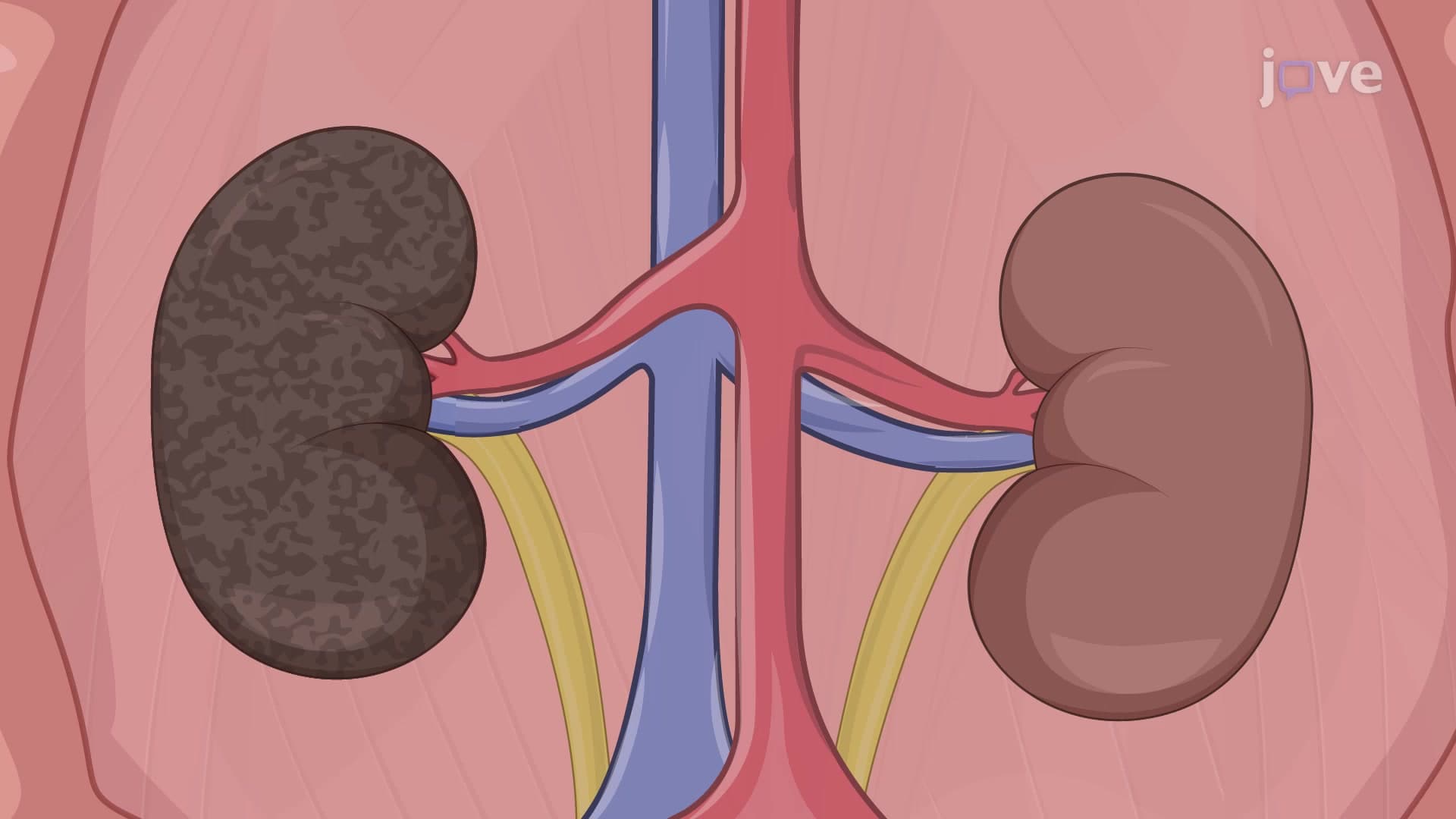Orthotopic Porcine Kidney Transplantation: A Technique to Transplant Graft Kidney in Porcine Model