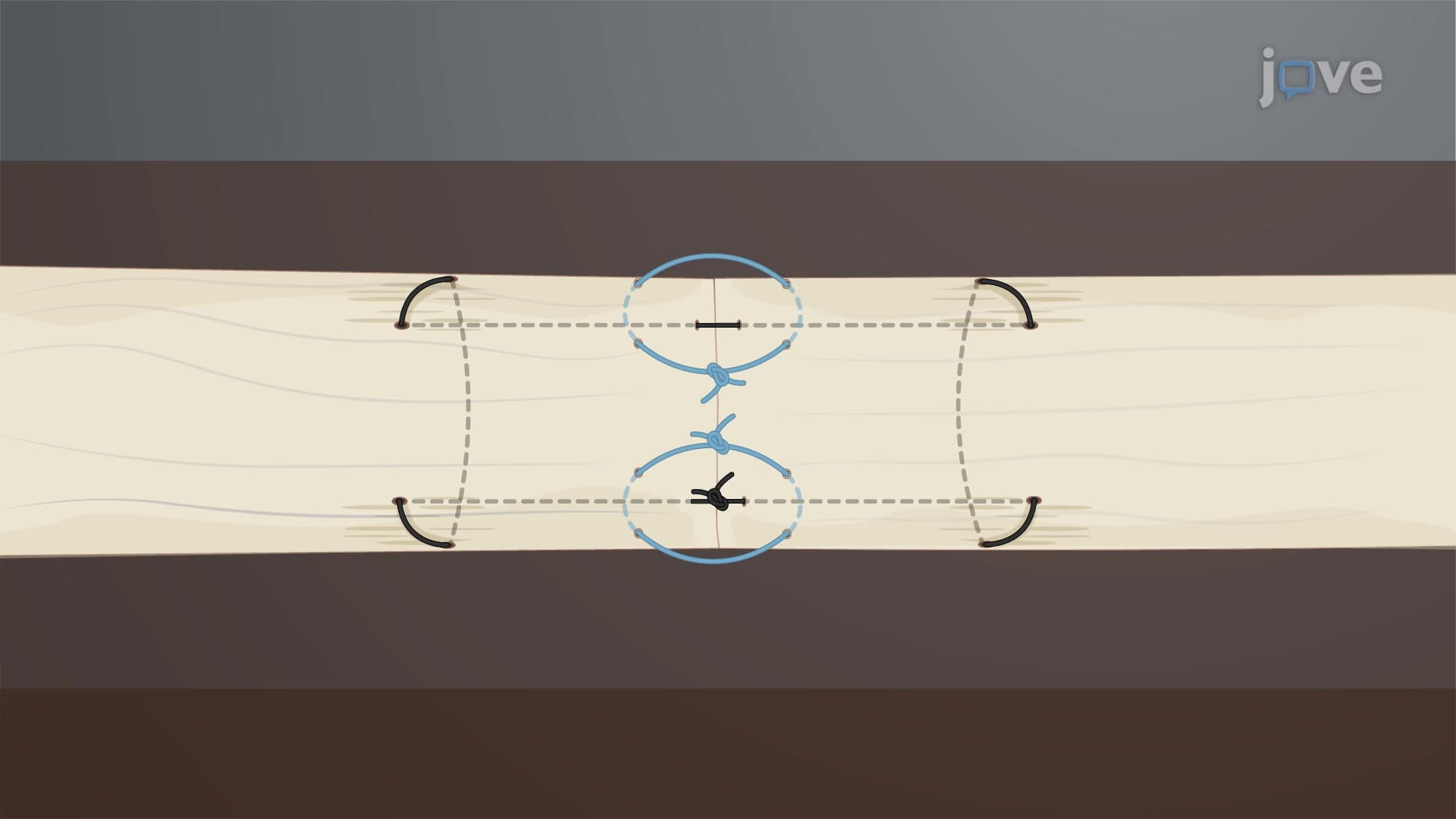 Q Suture Technique: A Suturing Technique to Reduce Gap Formation and Increase Tensile Strength in Tendon Repair