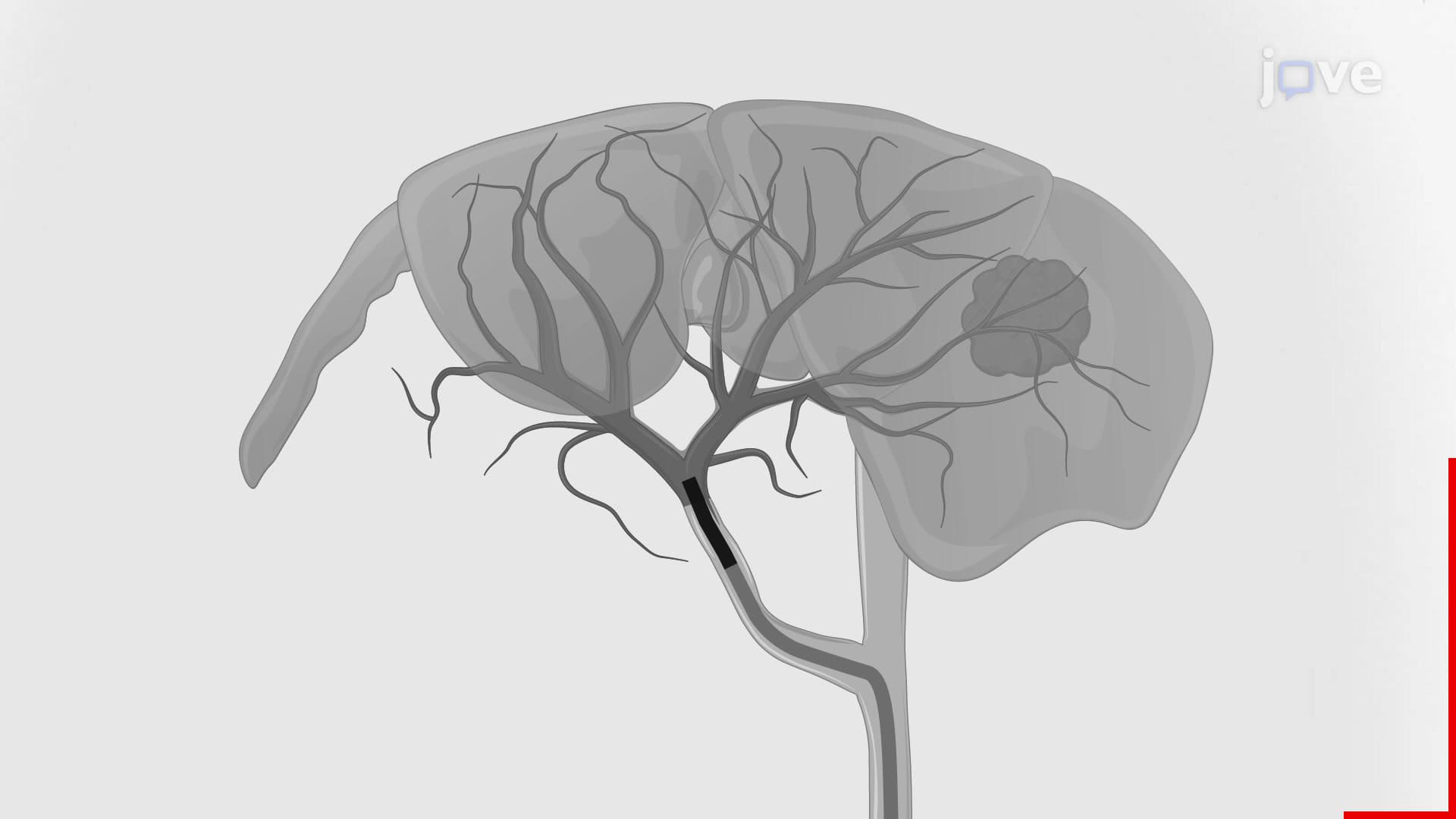Hepatic Angiography: A Procedure to Visualize Liver Tumor Vessels in a Rabbit Model