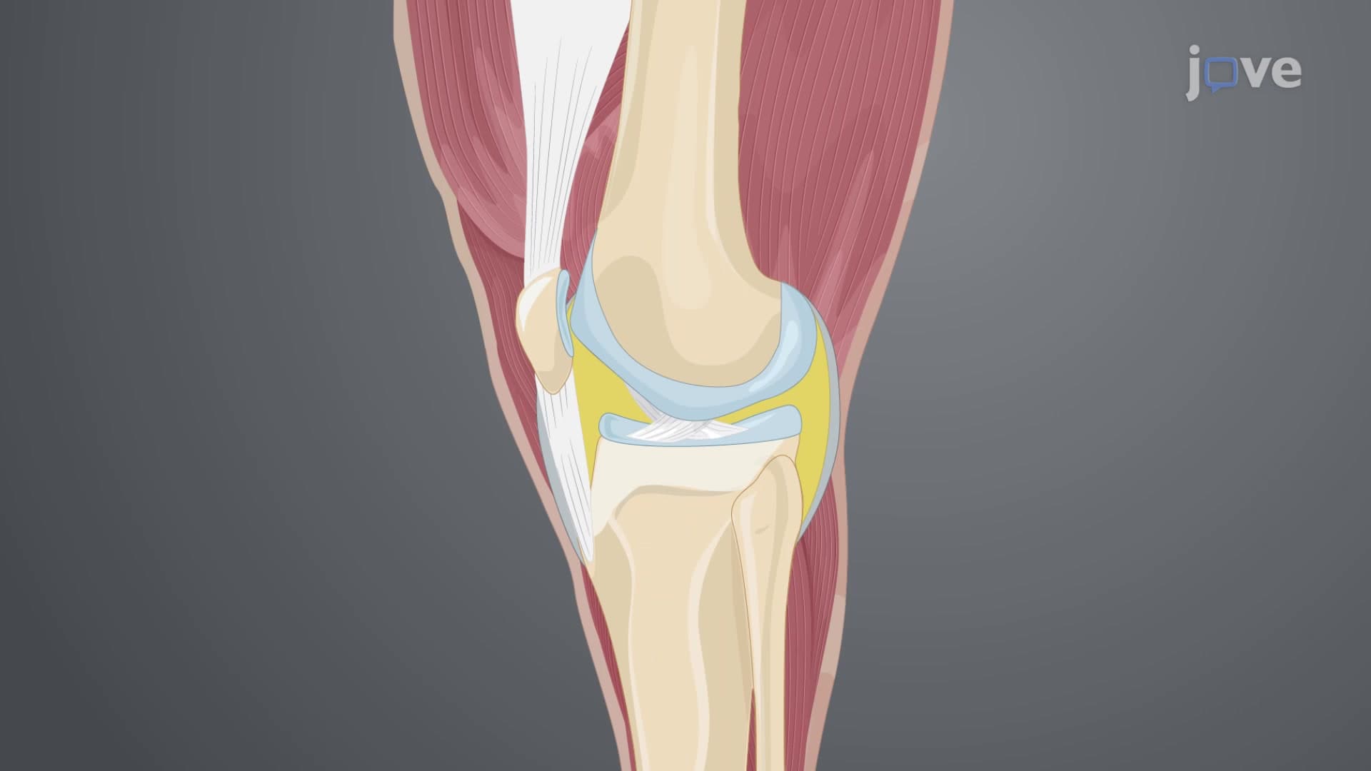 Harvesting Articular Cartilage From Joints of an Equine Donor: A Surgical Procedure to Isolate Vascular Connective Tissue From Cadaveric Joints of an Equine Donor