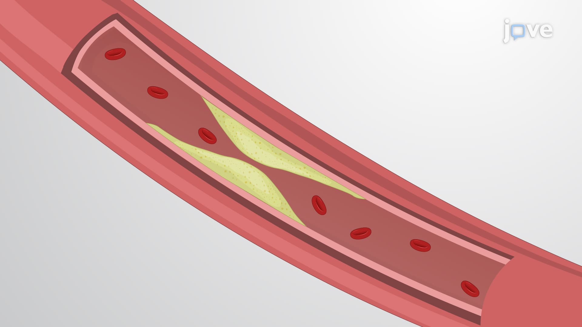 Assessing Vessel Perfusion via Angiography: A Technique to Introduce Contrast Agent in Descending Aorta to Visualize Blood Vessel Perfusion in Rabbit Model