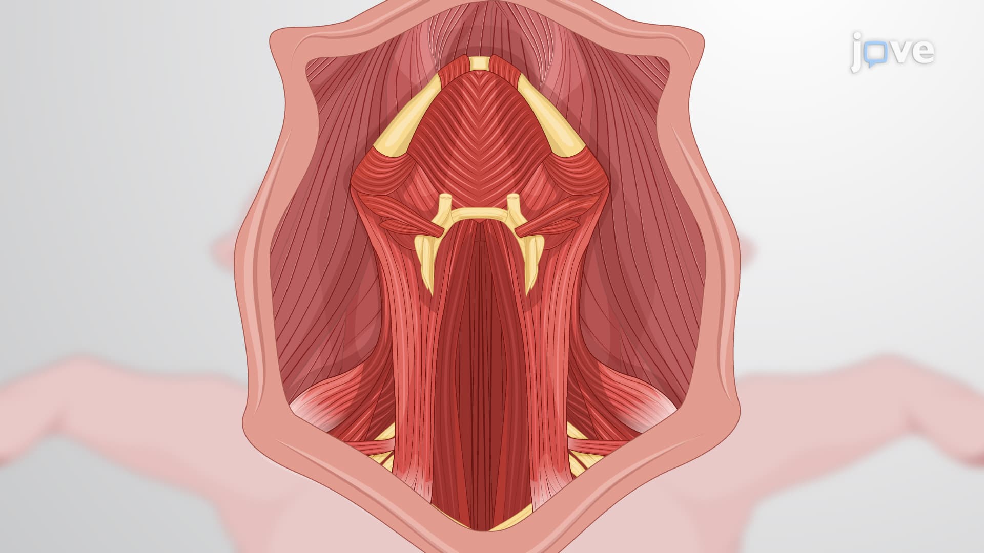 Automated Periodic Stimulation Electrode Installation: A Technique to Surgically Implant An Automated Stimulation Device on the Vagus Nerve in a Porcine Model