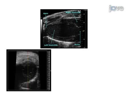 Murine Echocardiography and Ultrasound Imaging