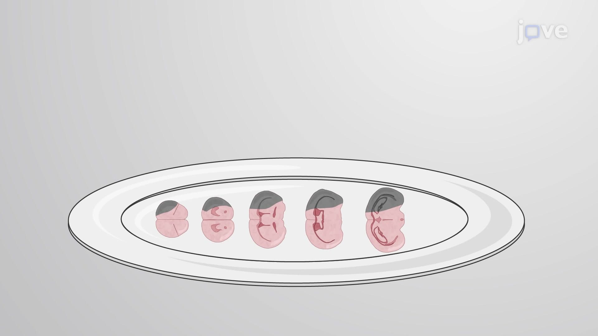 TTC Staining of Rat Brain Tissue Slices: A Staining Procedure to Differentiate Viable and Necrotic Tissue in Tissue Slices After Ischemia-Reperfusion Injury