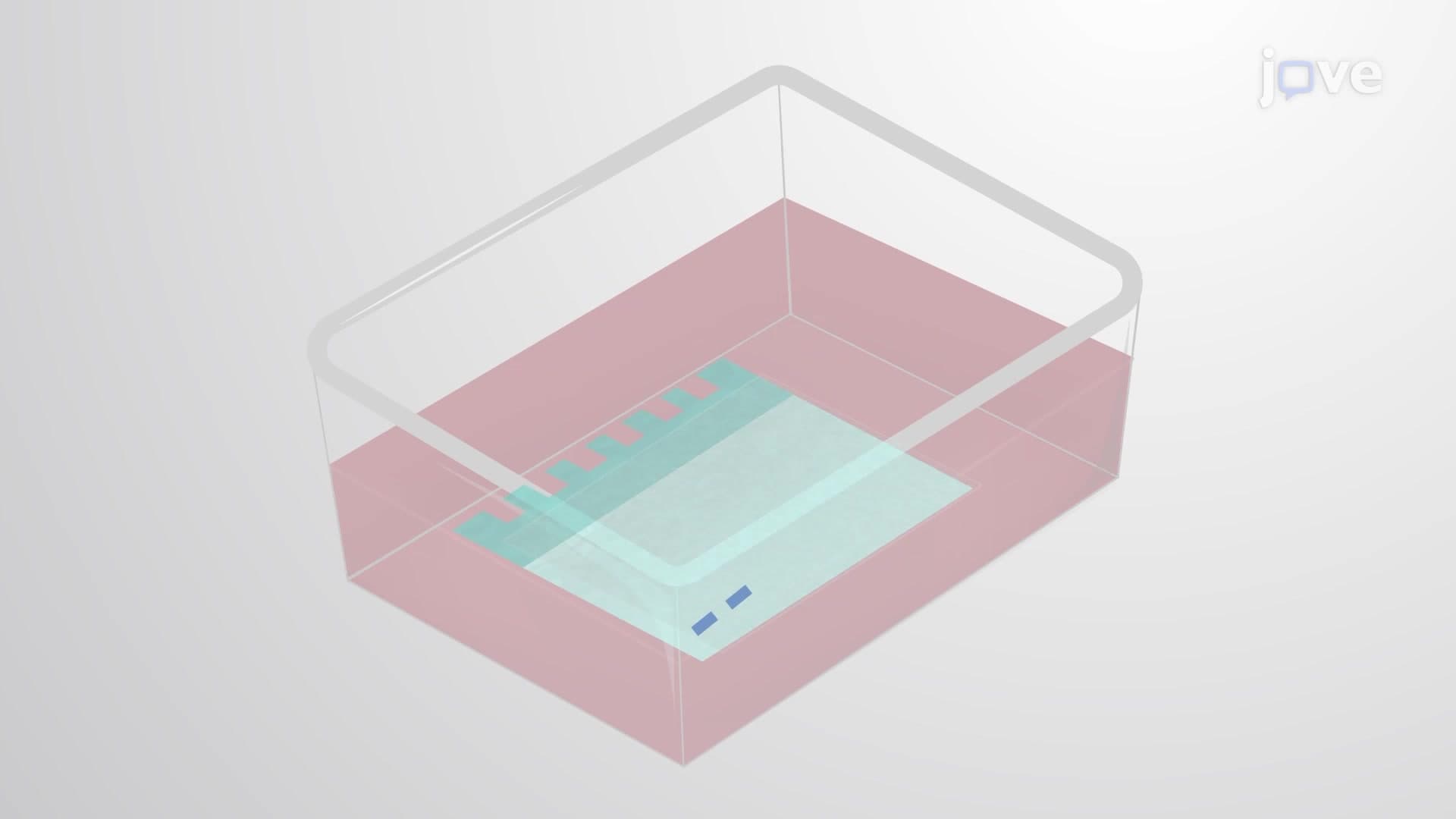 Zymography Gel Electrophoresis: An Electrophoretic Technique to Detect Matrix Metalloproteinases by Assessing the Enzymatic Activity